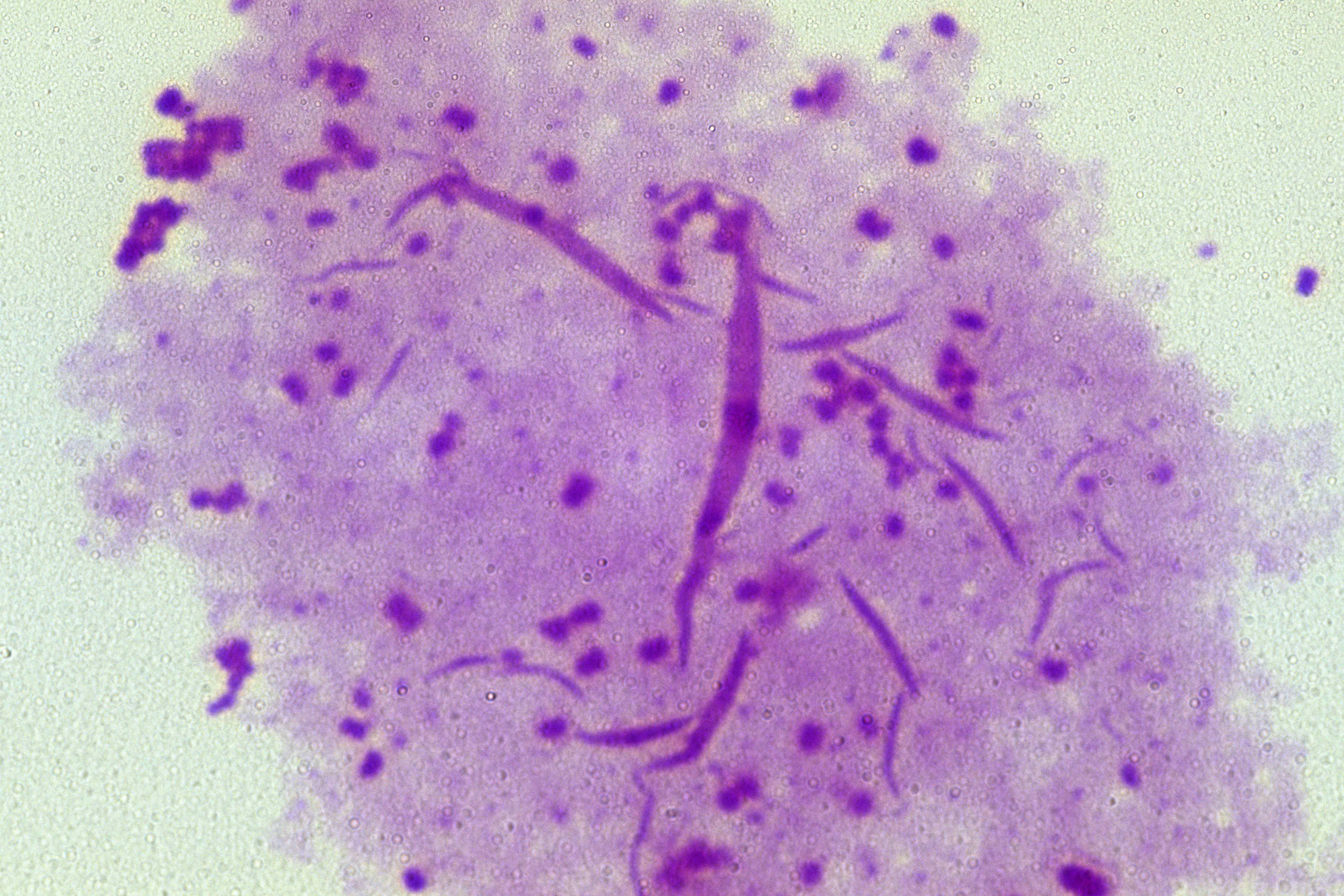 Gonorrhoea can usually be treated effectively, although some cases can be resistant to the antibiotic ceftriaxone, which is the first line of treatment (Alamy/PA)