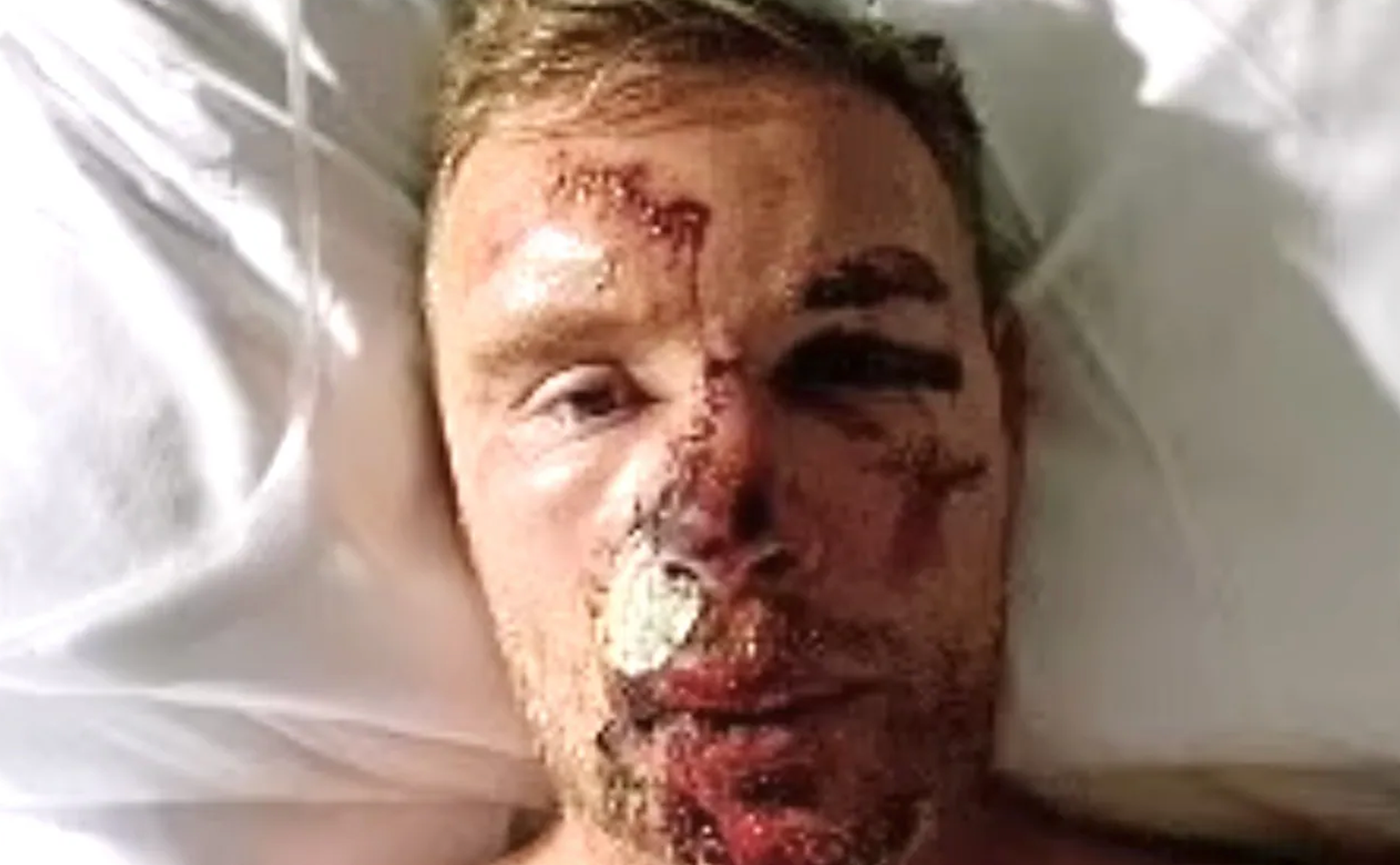 The cricketer received £9m in compensation as a result of his injuries and production on ‘Top Gear’ was suspended indefinitely