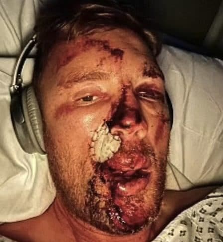 Freddie Flintoff has revealed a split-second decision saved his life during his terrifying ‘Top Gear’ crash