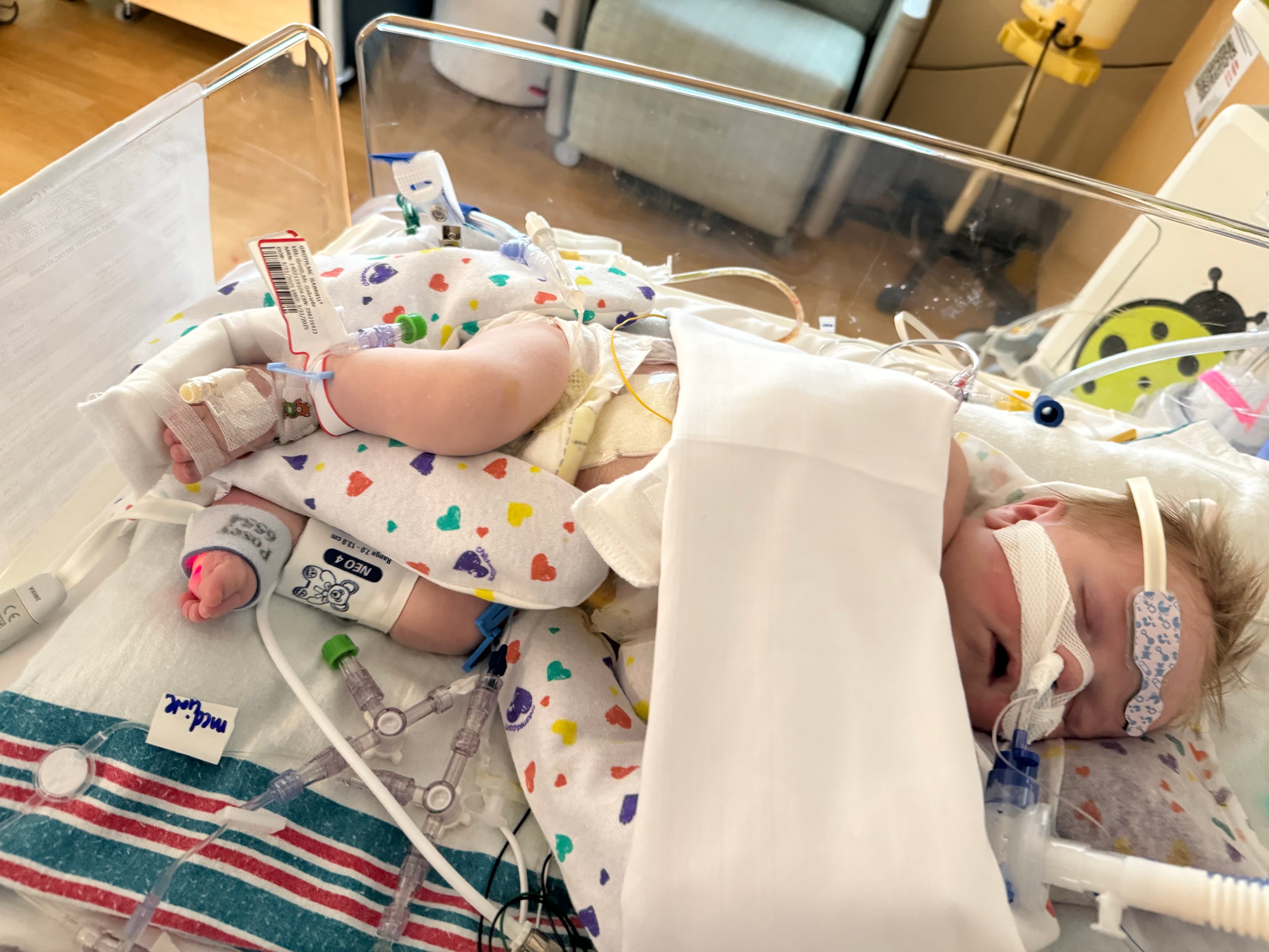 Cole Jordan Groth remains hospitalized as his parents hope for good news following a circumcision that nearly killed the newborn.