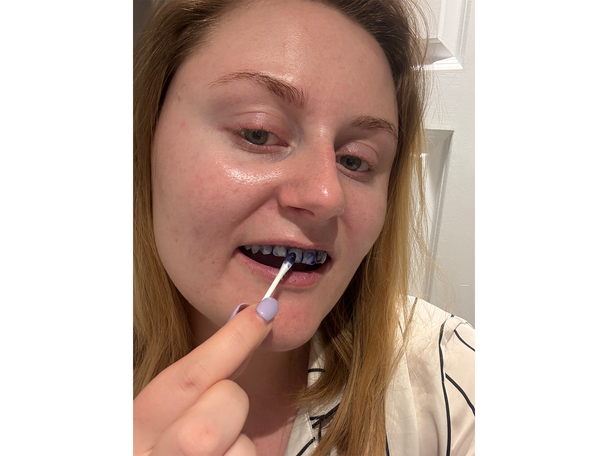 HiSmile testing best teeth whitening kits review indybest