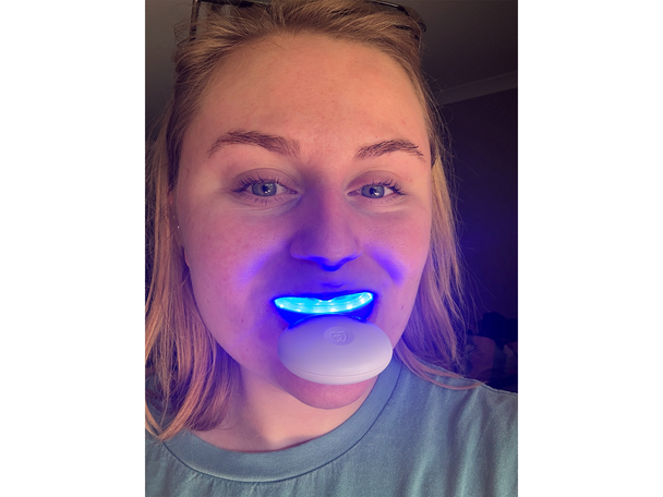 Spotlight testing best teeth whitening kits review indybest