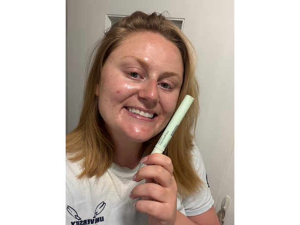 Gem testing best teeth whitening kits review indybest