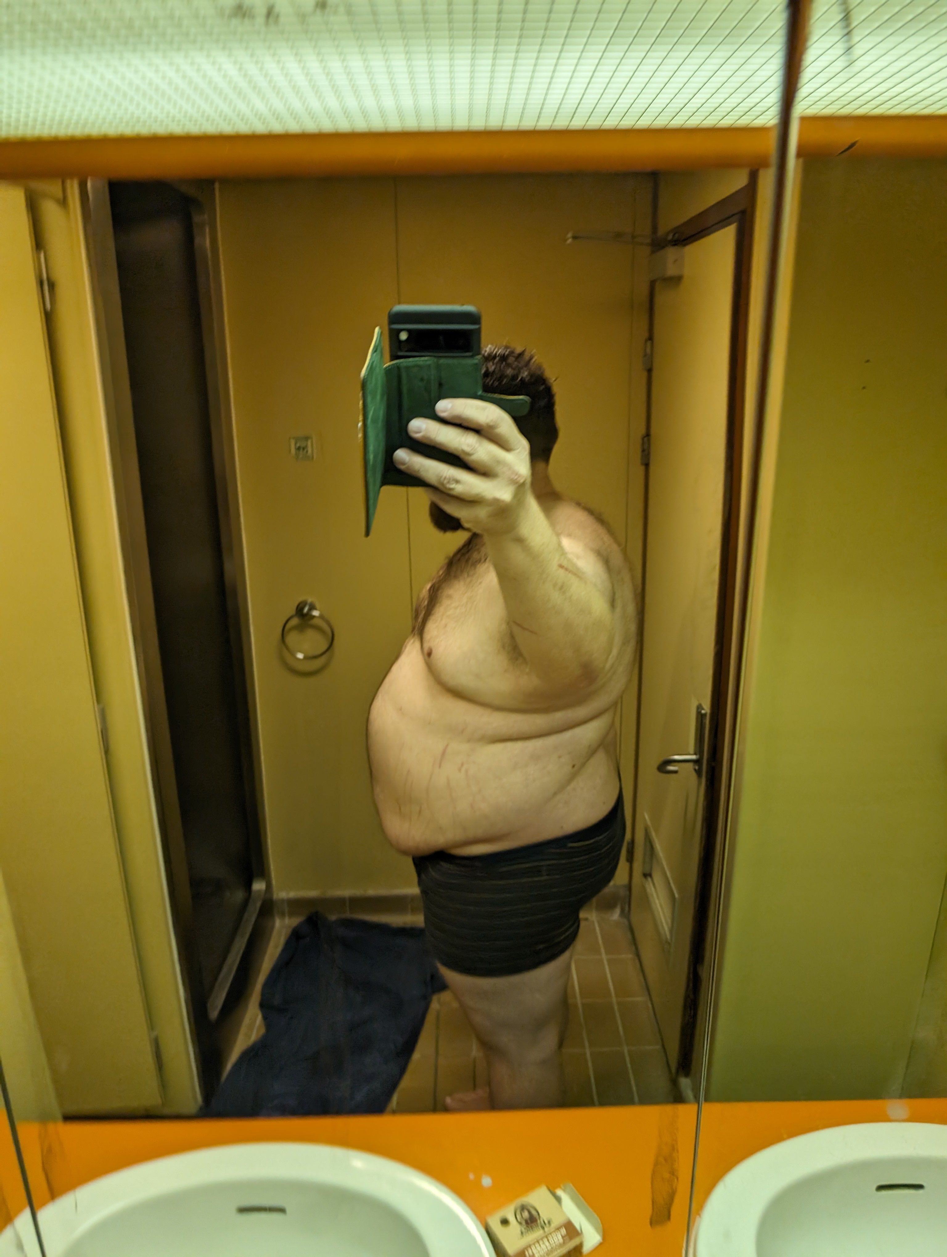 Dan Shilling at the beginning of his weight loss journey