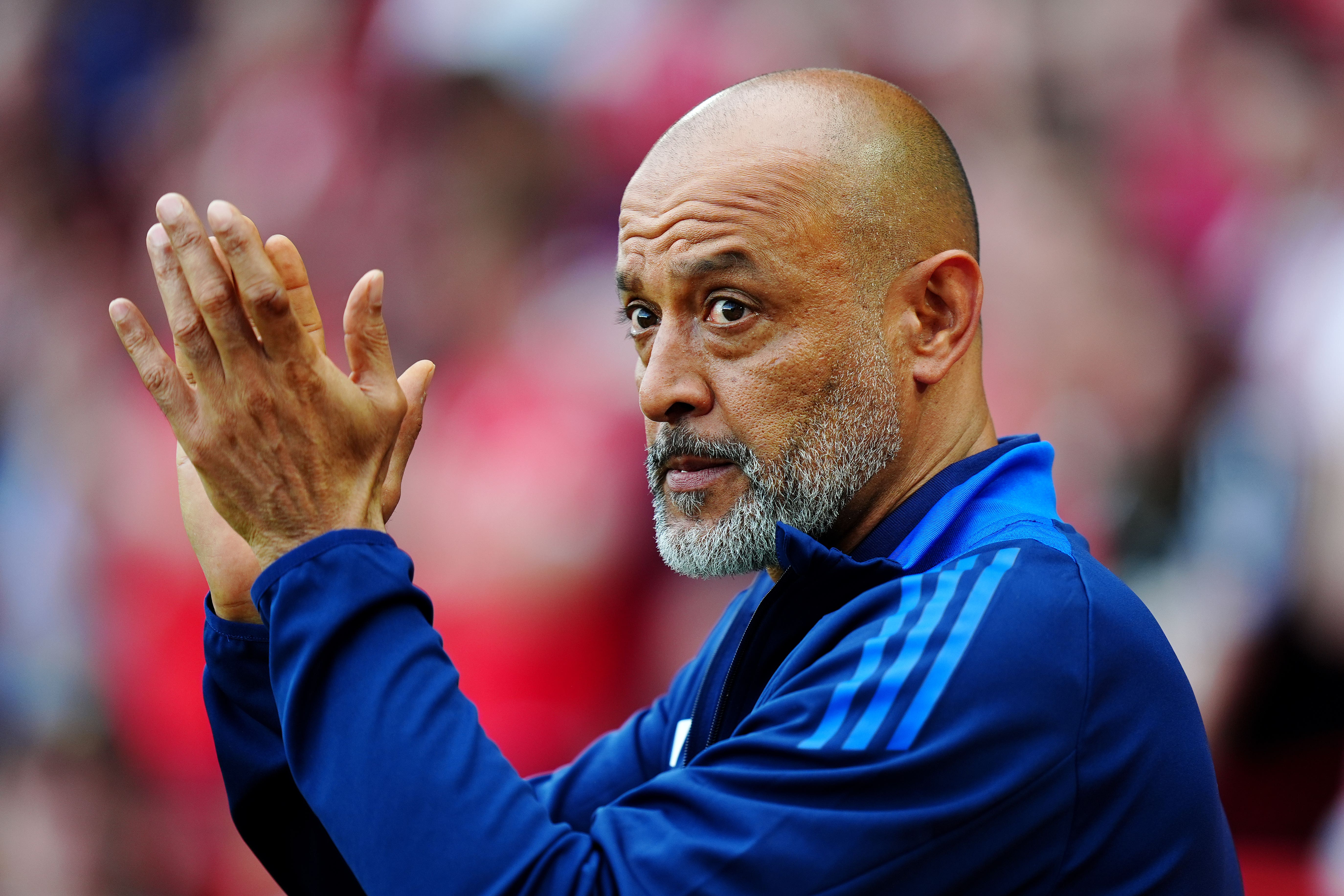Nottingham Forest manager Nuno Espirito Santo says his side are struggling (Mike Egerton/PA)