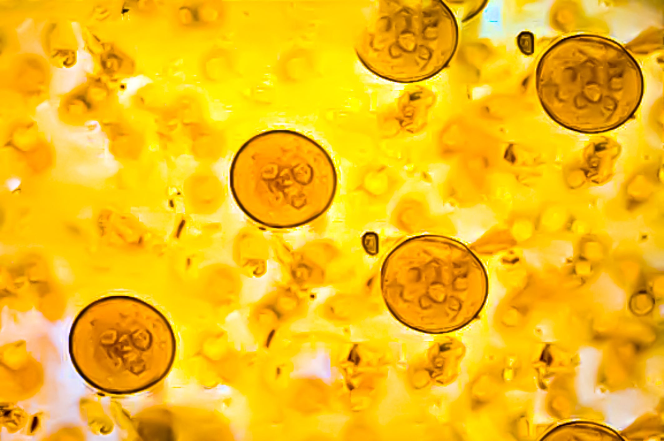 Crytosporidiosis is a parasitic disease caused by the Cryptosporidium protozoan in the vertebrate animal