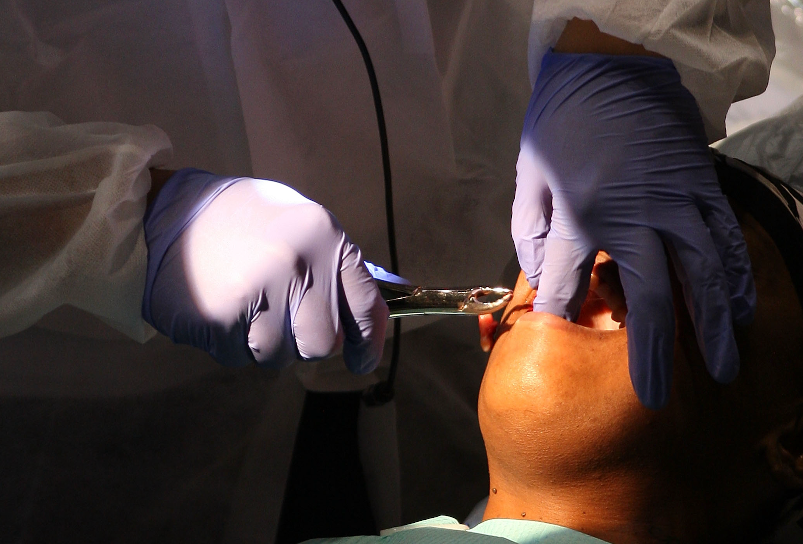 A root-canal-gone-wrong ended up in a lawsuit for one New York man. He accused the dentist of sexually harassing him during the procedure.