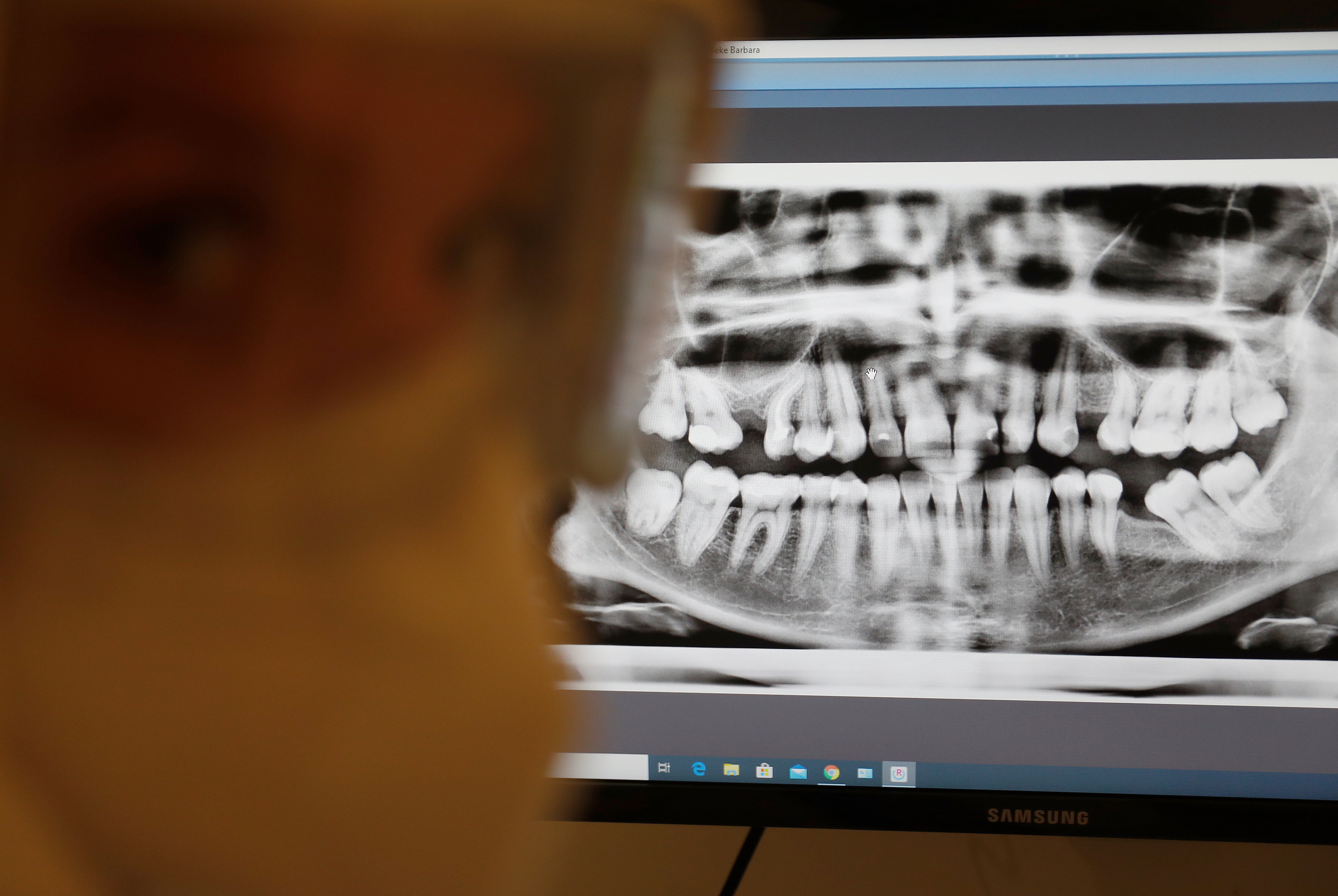 The dental technician in the room "became visibly uncomfortable" with what was going on, according to Makke Dakhlaoui's complaint