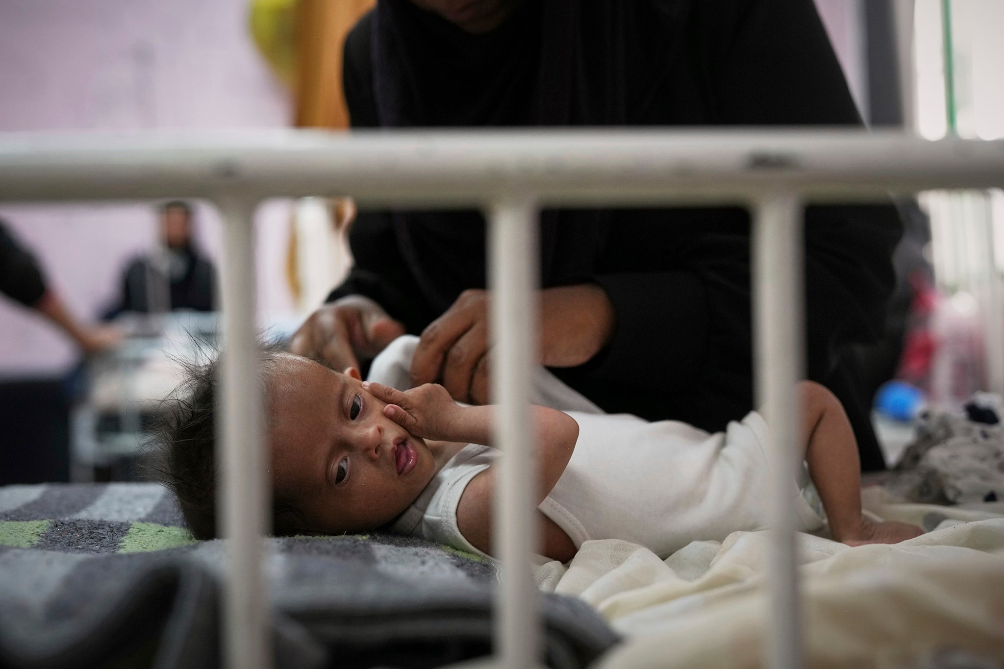 Rahma al-Qadi cares for her 7-month-old daughter Sama, who was born with Down syndrome and suffers from malnutrition, at the malnutrition clinic in Nasser Hospital, 1 May
