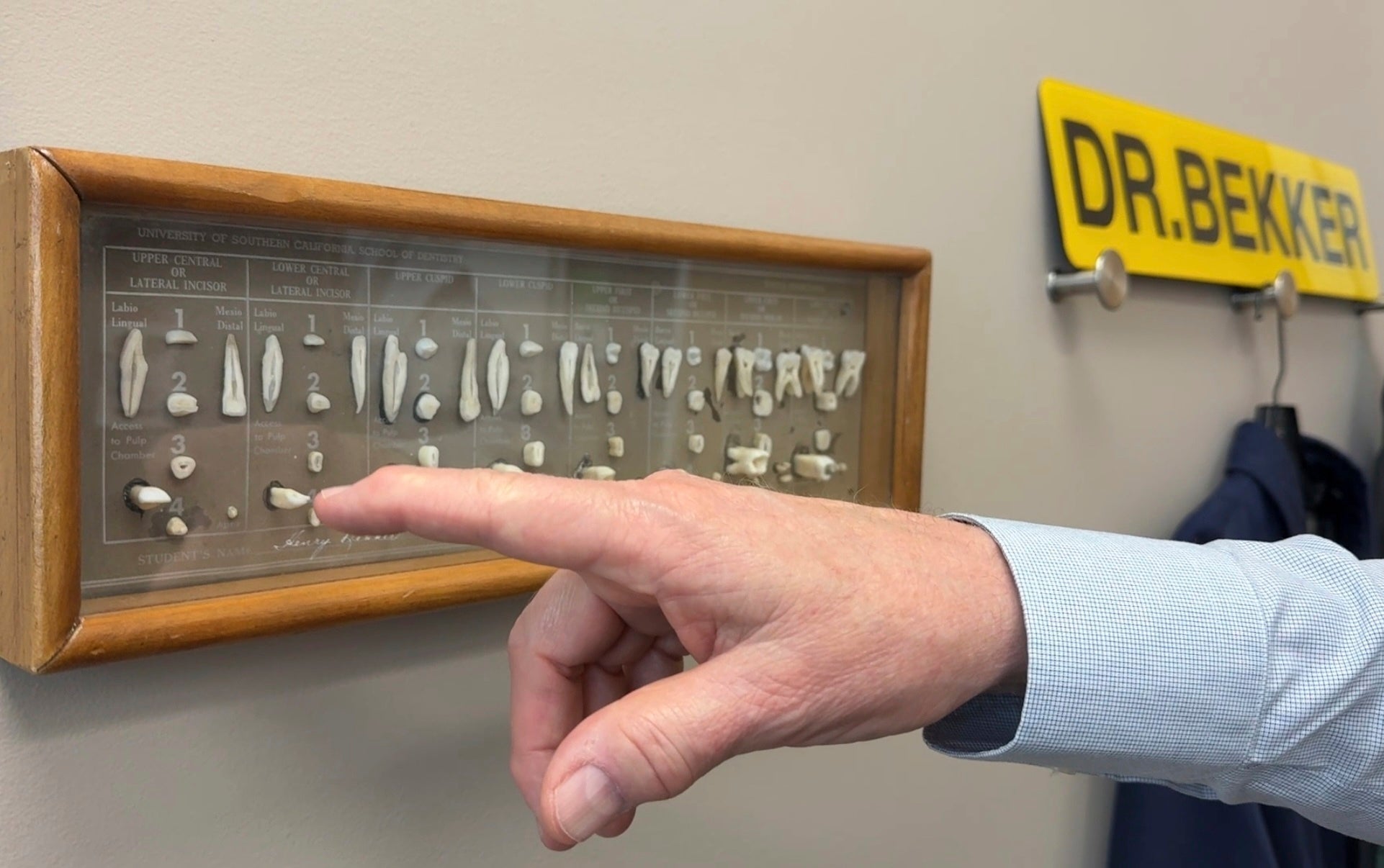 Dentist James Bekker points to his model of dissected human teeth while explaining the effects of removing fluoride from public drinking water, April 30, 2025, at his office in Salt Lake City, Utah. (AP Photo/Hannah Schoenbaum)
