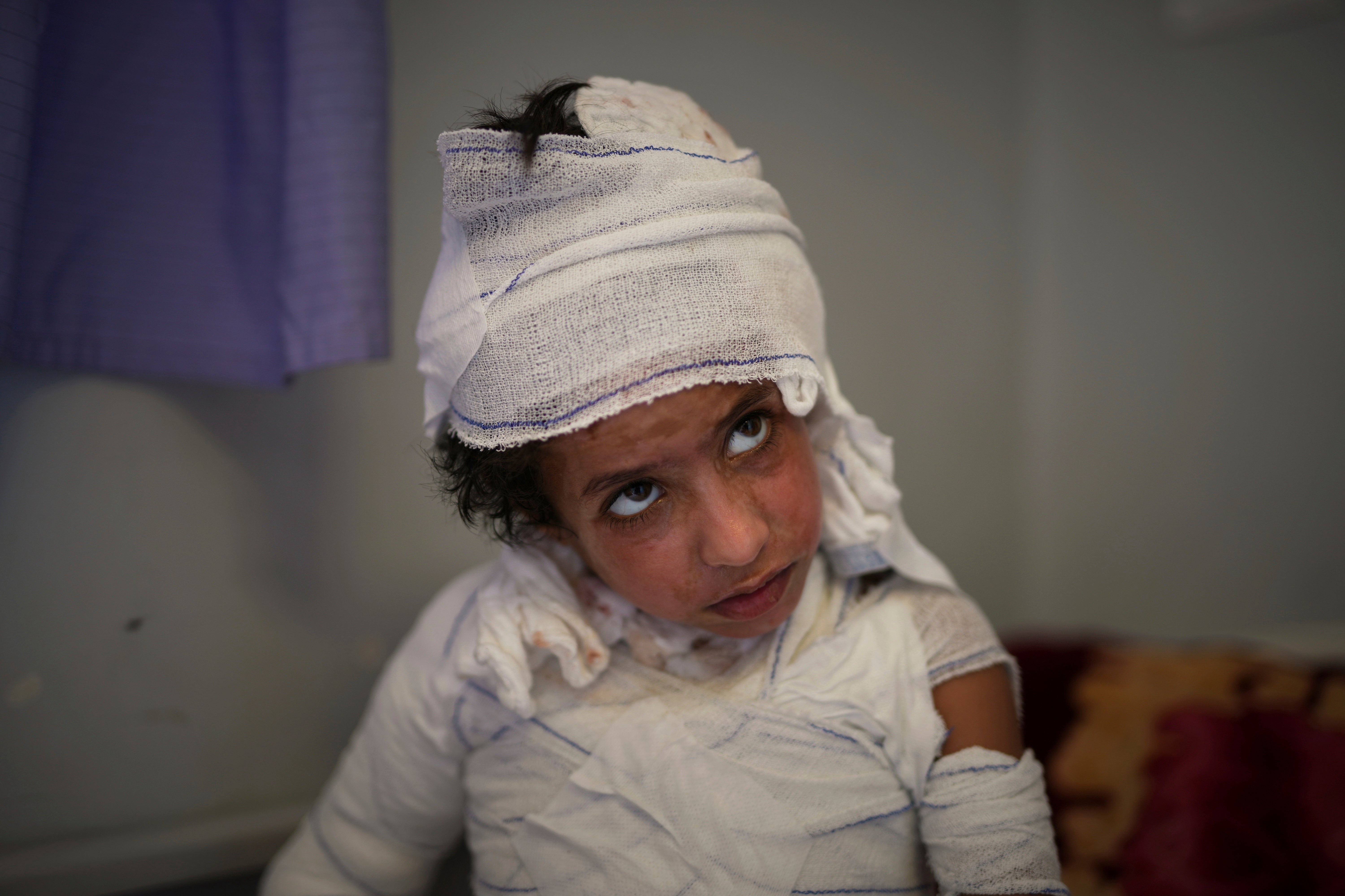 Mideast Wars Gaza Burns