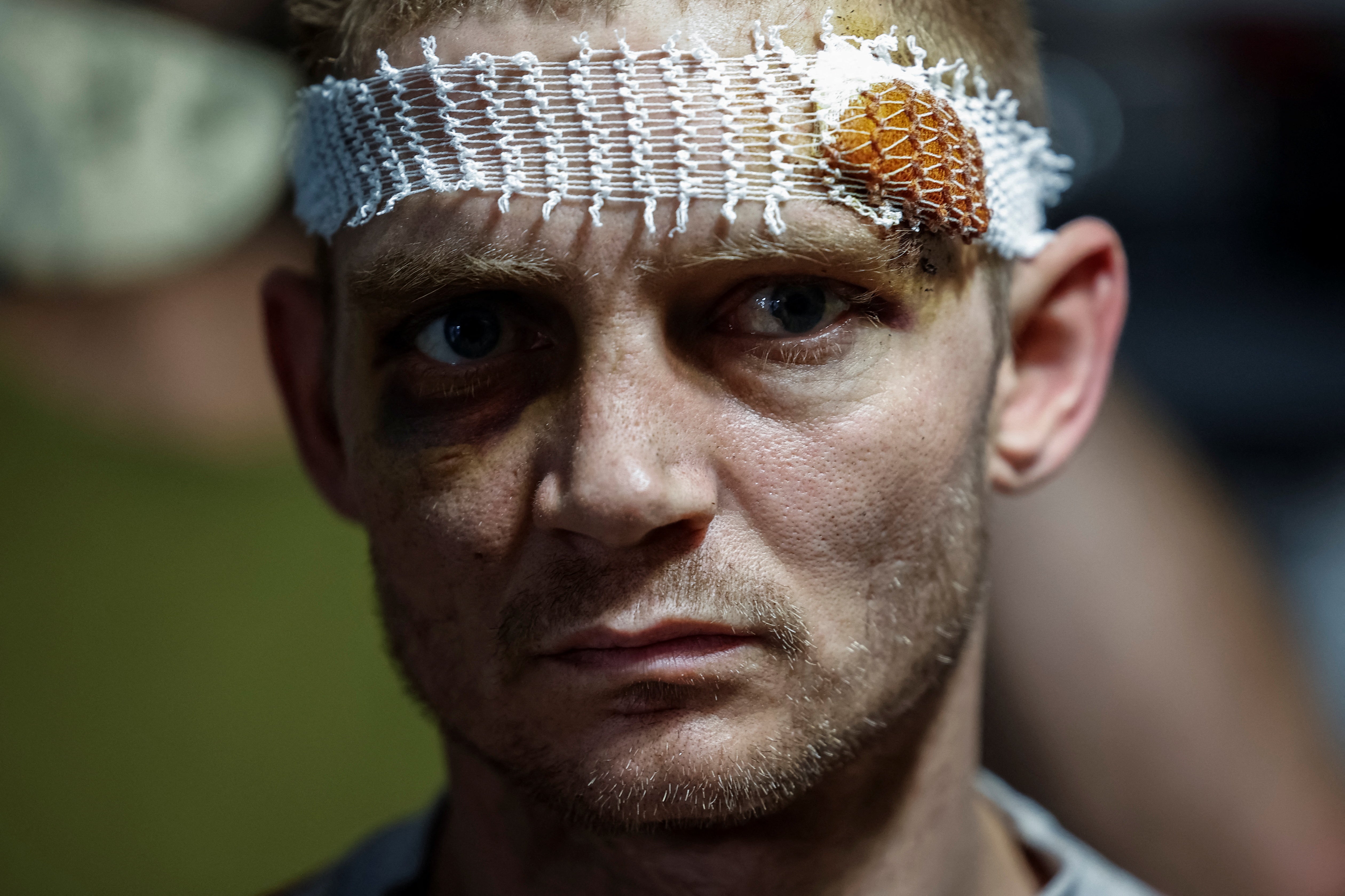 Artur, a wounded Ukrainian serviceman of the 128th Separate Mountain Assault Transcarpathian Brigade of the Armed Forces of Ukraine, looks on at a medical stabilisation point after treatment, amid Russia's attack on Ukraine, in Zaporizhzhia region, Ukraine May 9, 2025. REUTERS/Alina Smutko