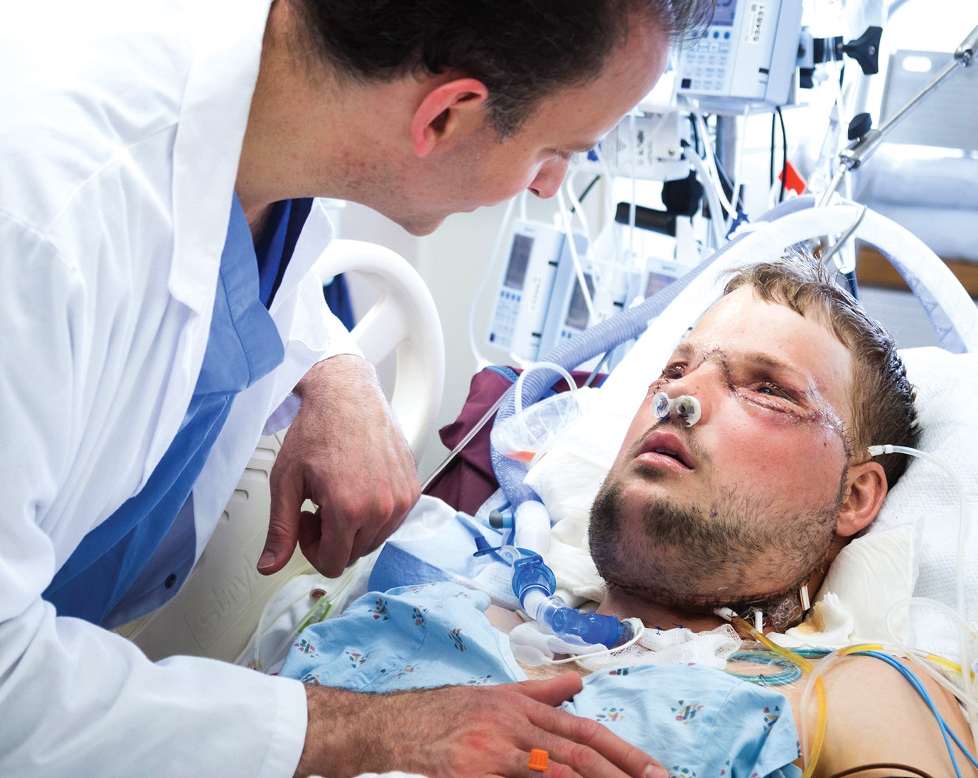 When Andy woke from the surgery, he didn't have functionality in his new face. He continued to work through exercises for two years afterwards to be able to smell, eat and see properly