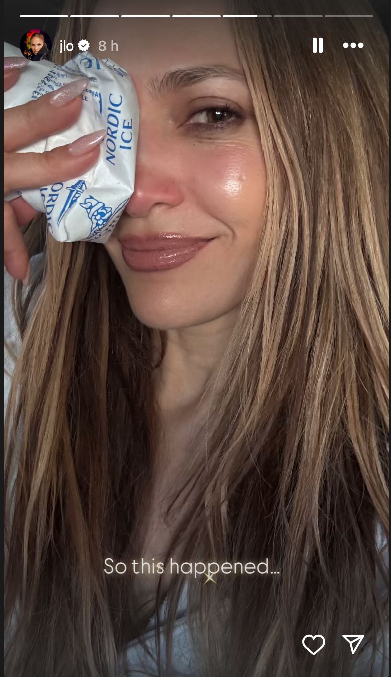Singer said ‘a whole lotta ice’ had been involved in her recovery