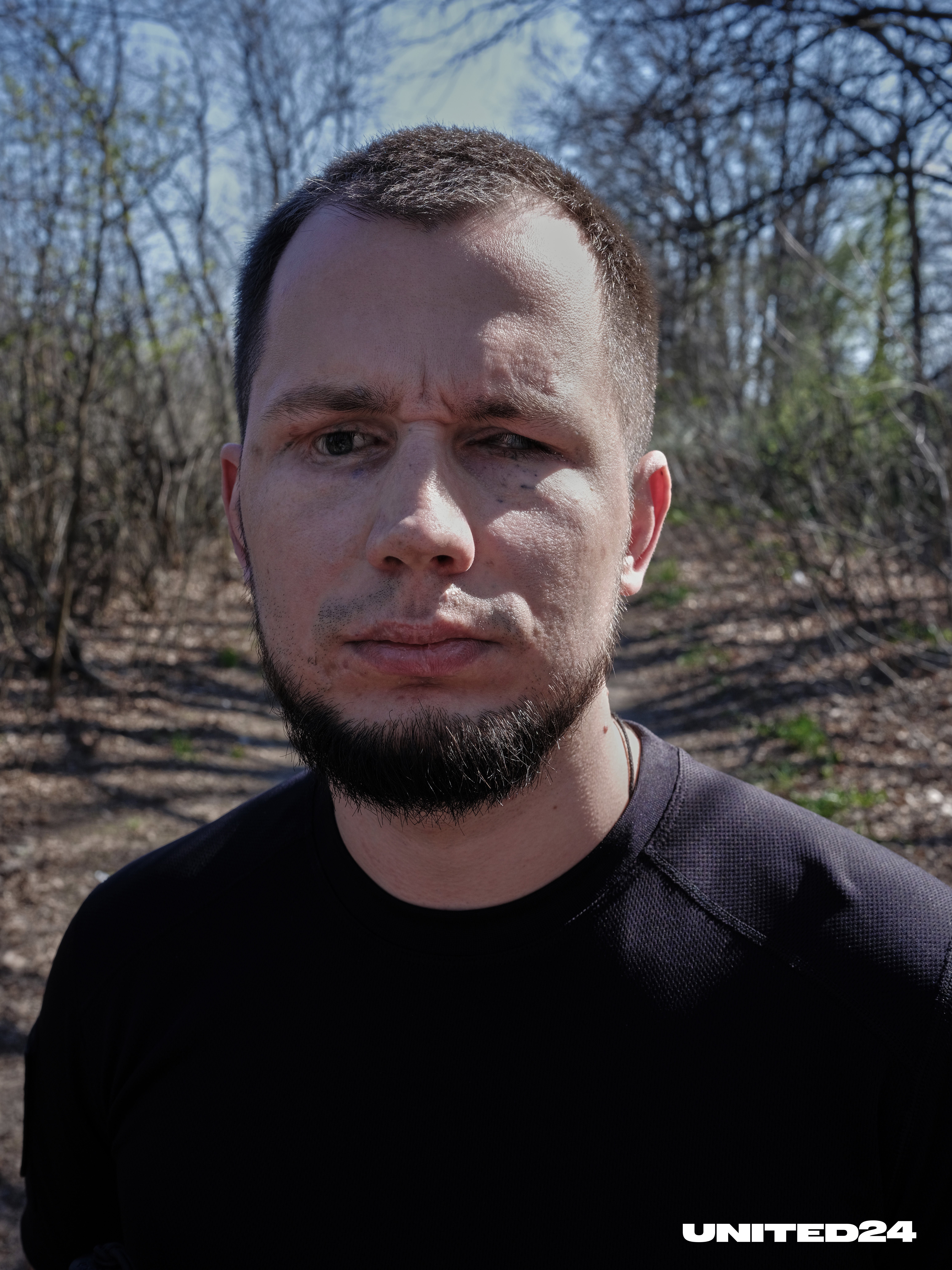 Dmytro Slepkan now works with other victims of landmine explosions