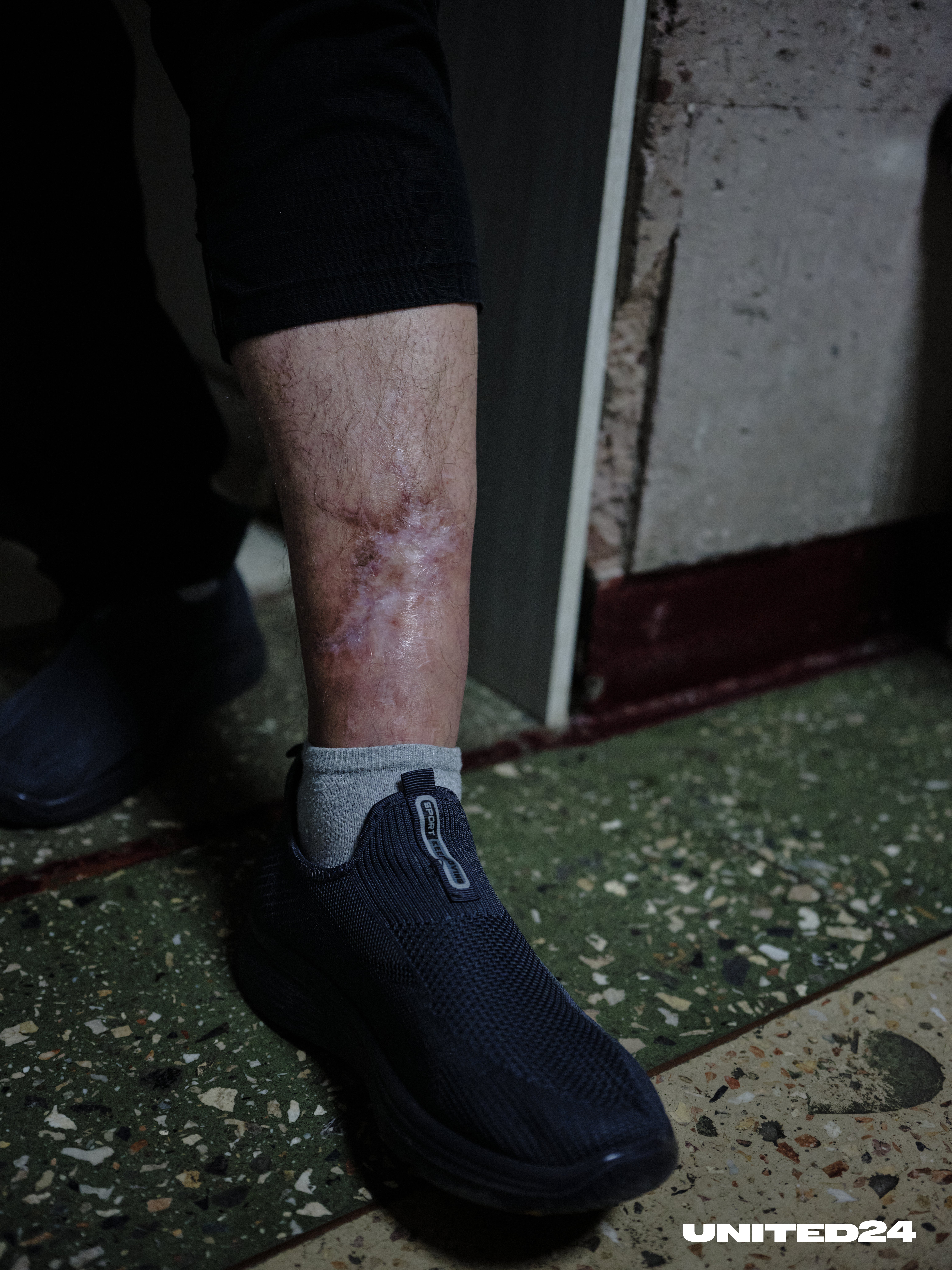 Doctors told Guzha he risked losing his leg