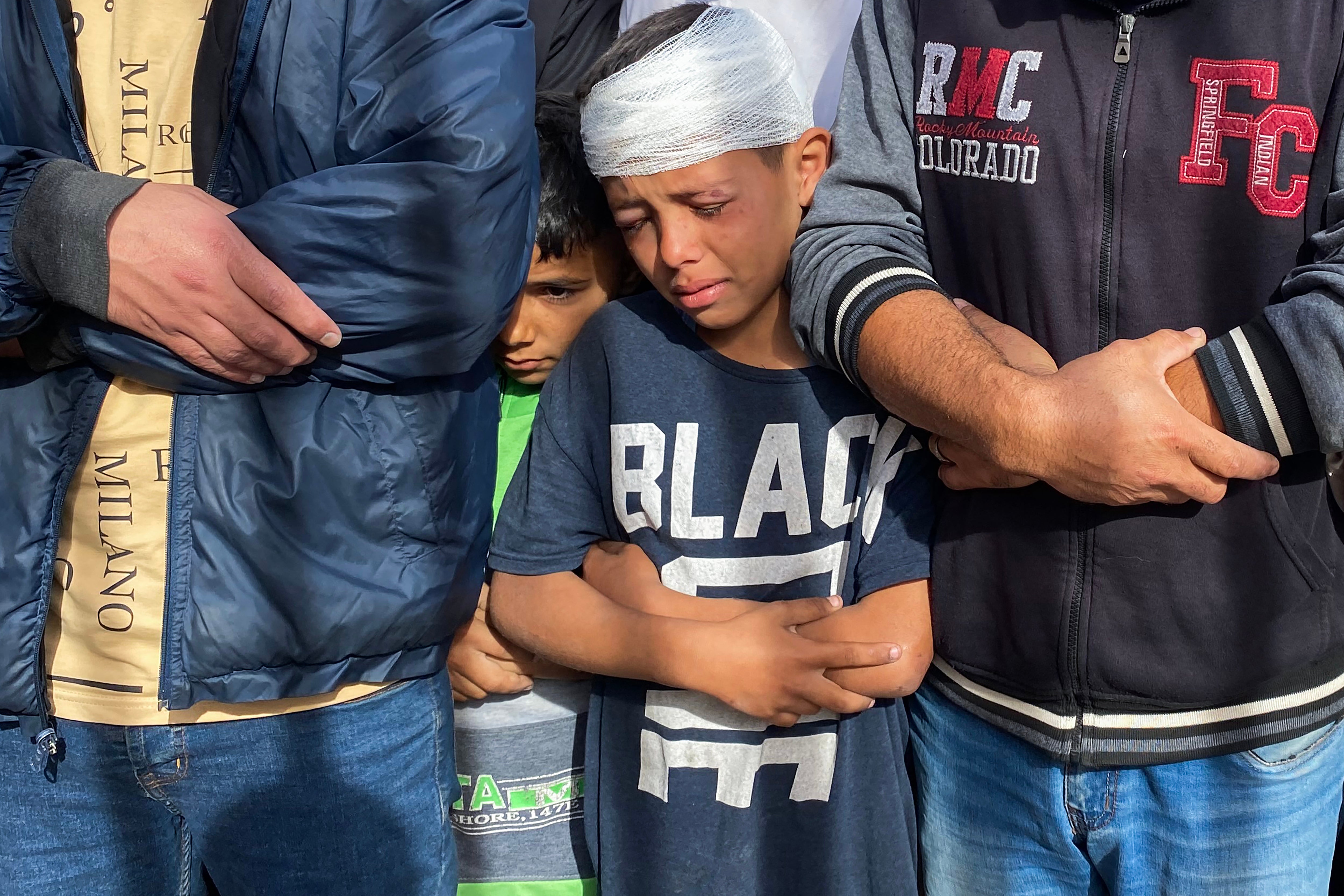 A wounded Palestinian boy cries as he joins prayers for the casualties of Israeli strikes outside the Nasser hospital in Khan Yunis in Gaza