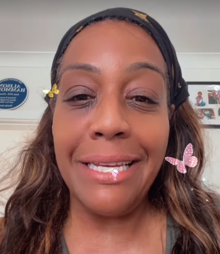 Alison Hammond said she felt like she had been ‘hit by a bus’