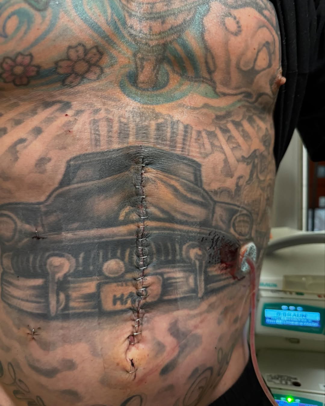 Carey Hart