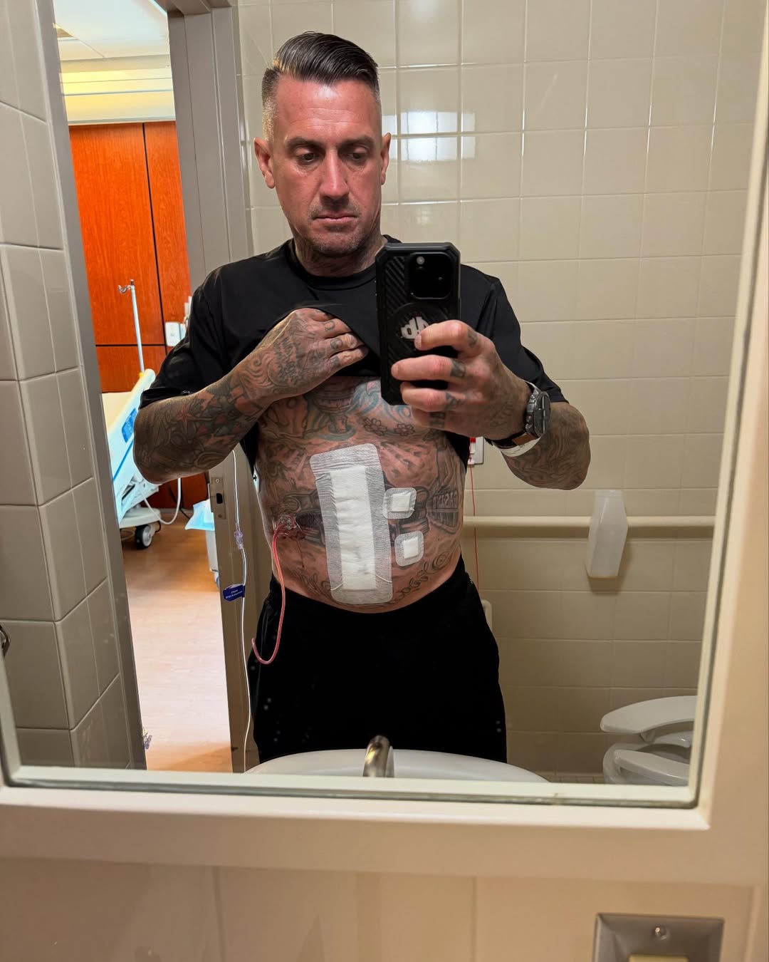 Carey Hart