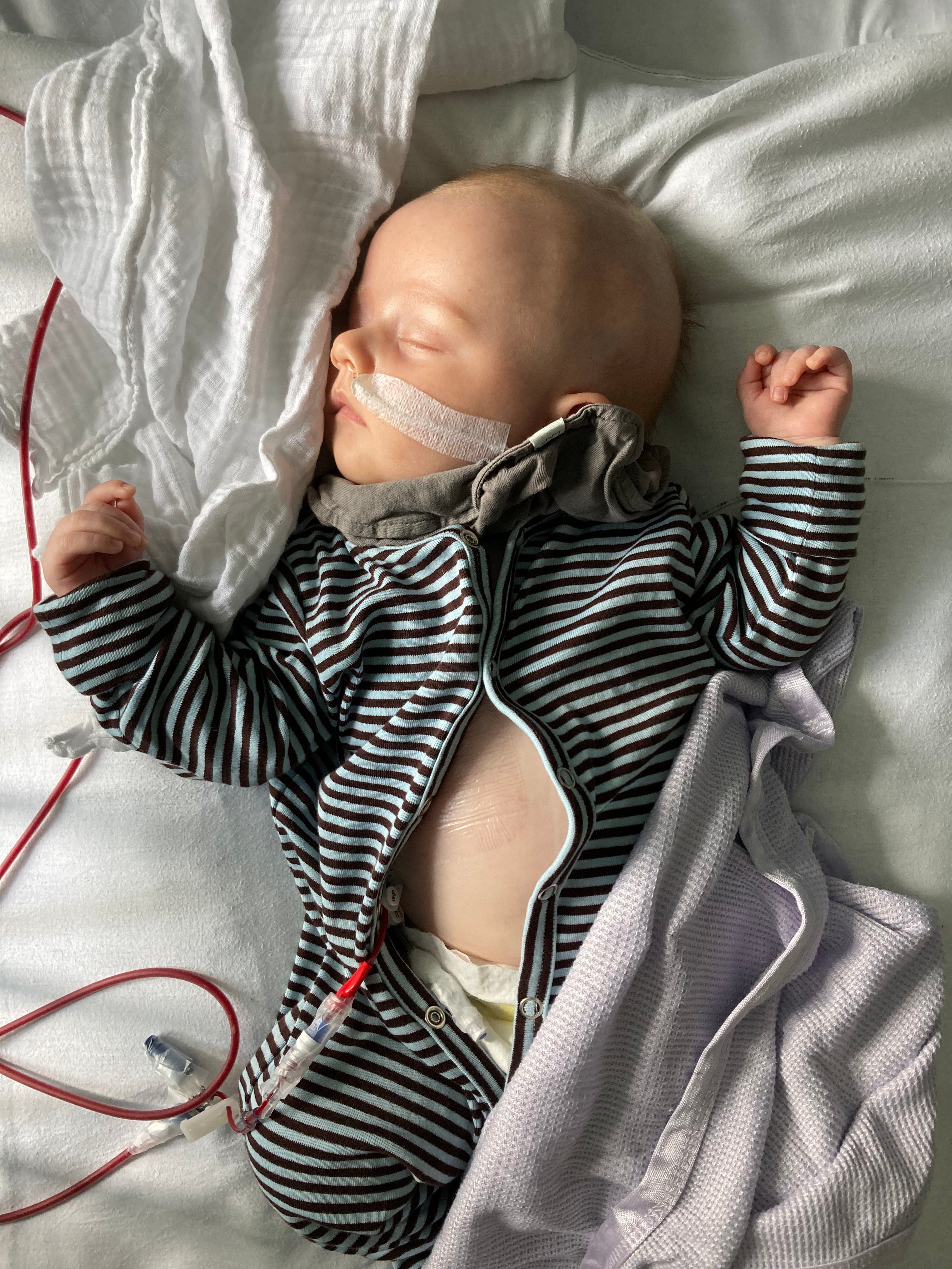 Nelson recebe seu transplante
