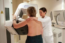 New breast cancer treatment may ‘transform’ care and reduce debilitating side effects