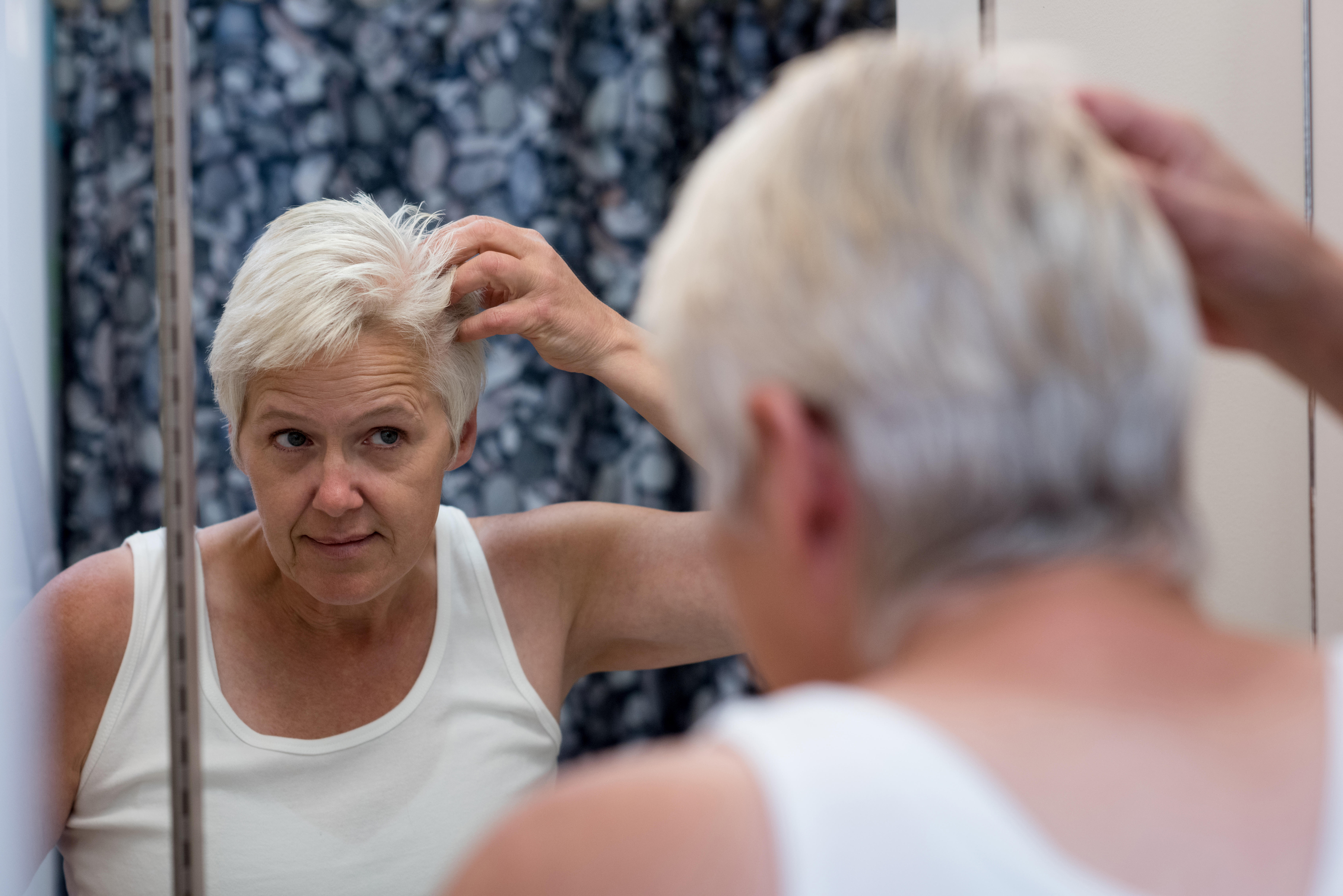 Here are non-hormonal methods to thicken hair (Alamy/PA)