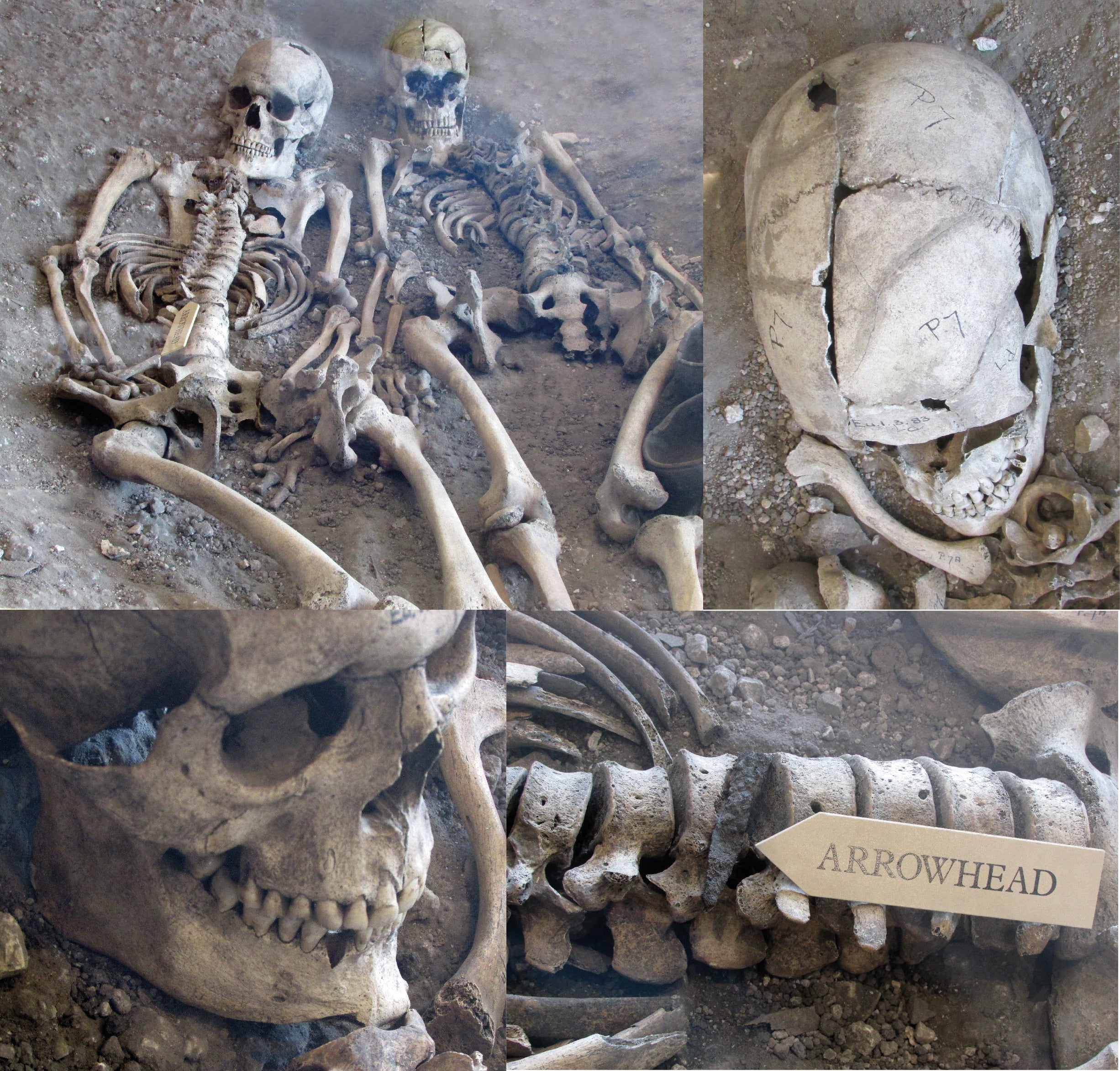 The skeletons were found smashed in the 1930s at a mass burial pit in Dorset