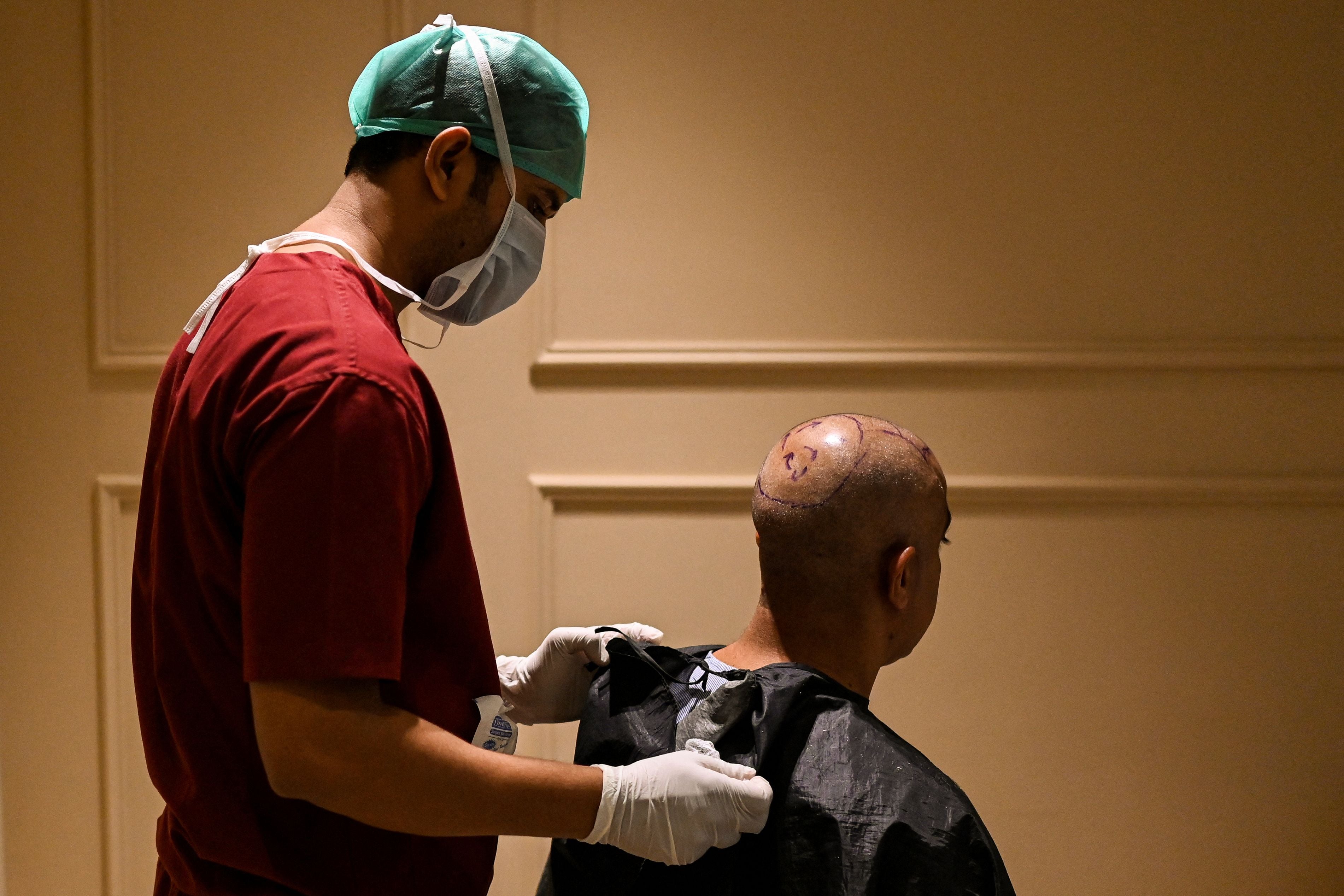 An operation theatre technician (OT) attends a patient before a hair transplant patient (stock image)