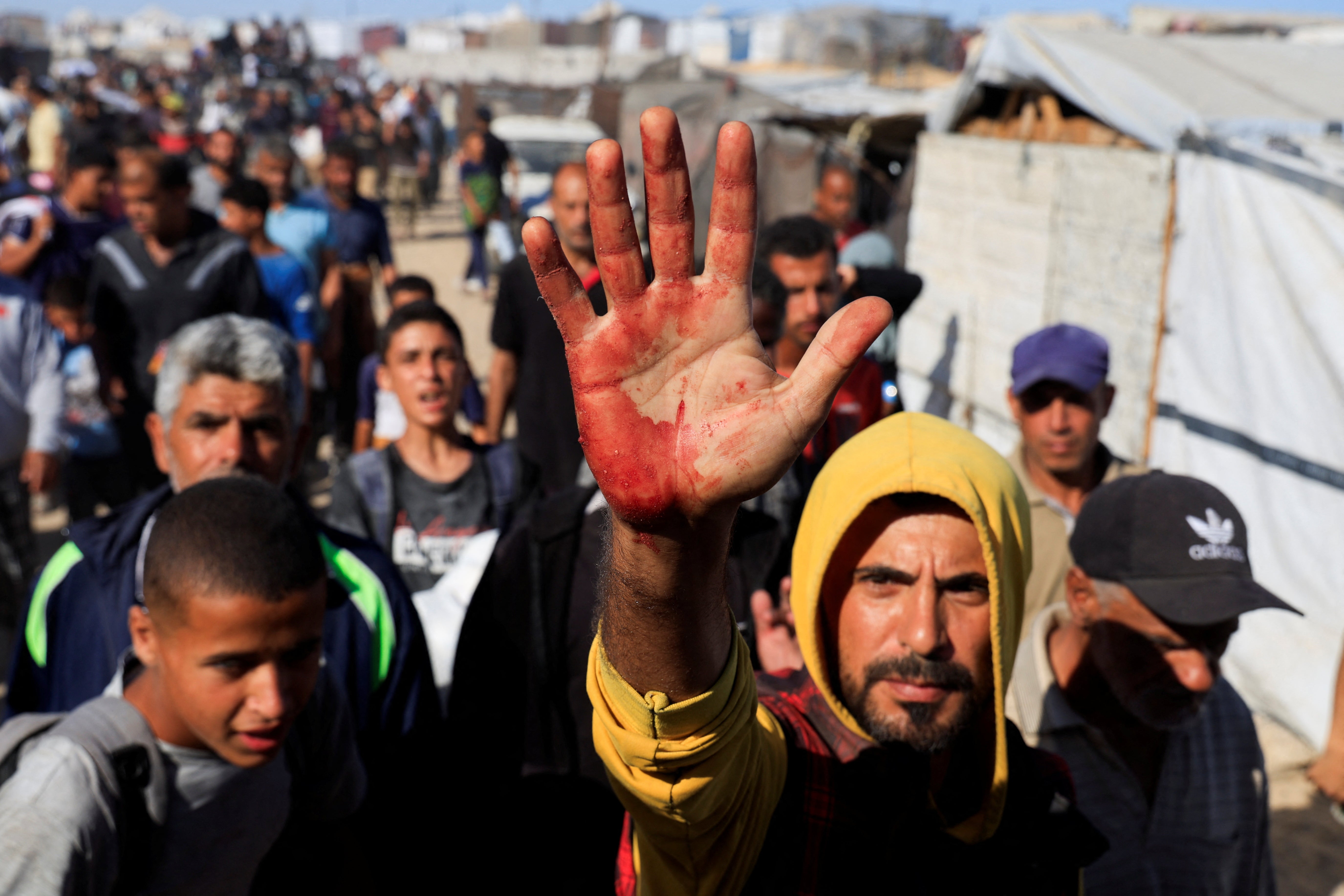 A Palestinian man shows blood stains on his palm after collecting aid supplies from the US-backed Gaza Humanitarian Foundation
