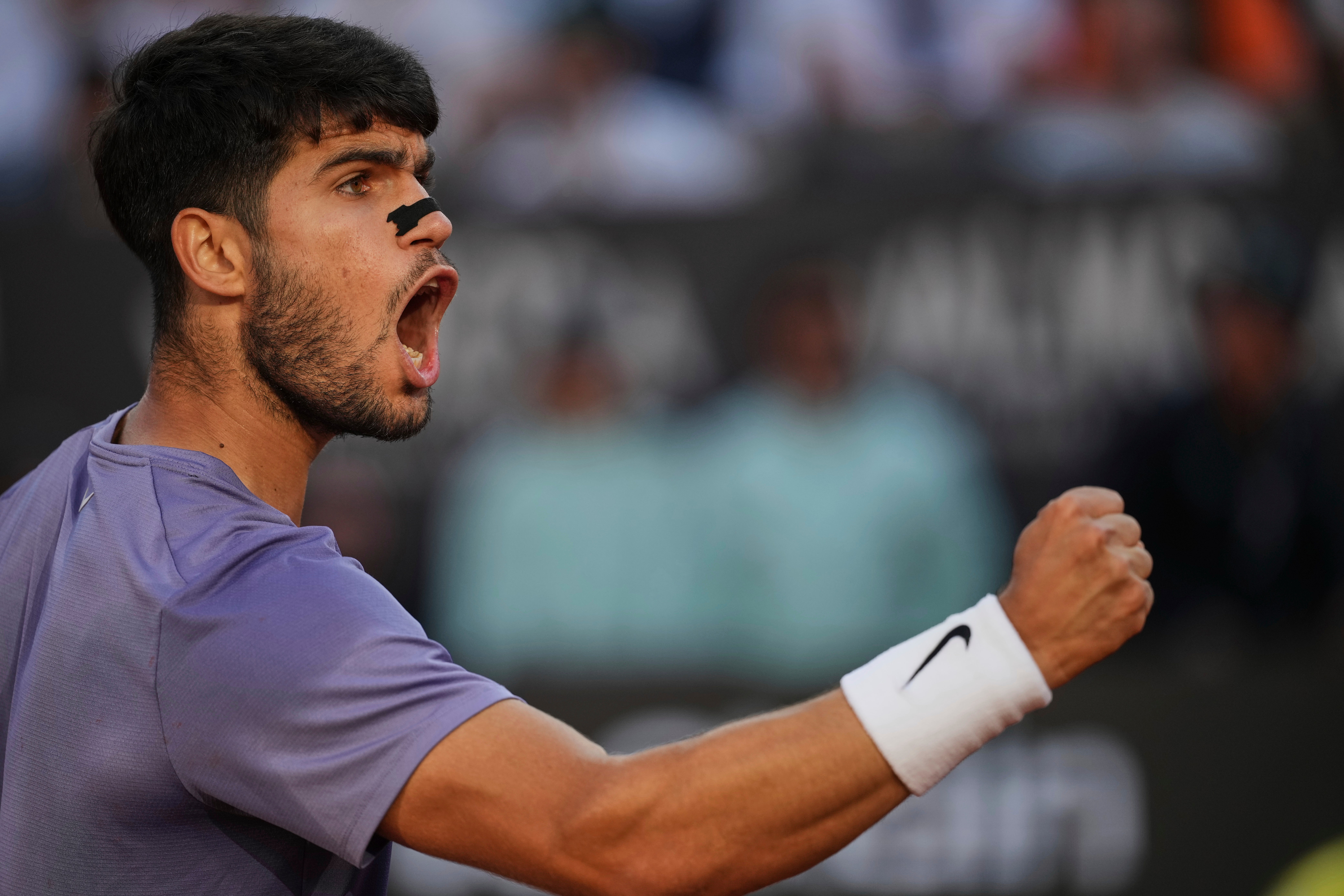 French Open Nose Strips Tennis