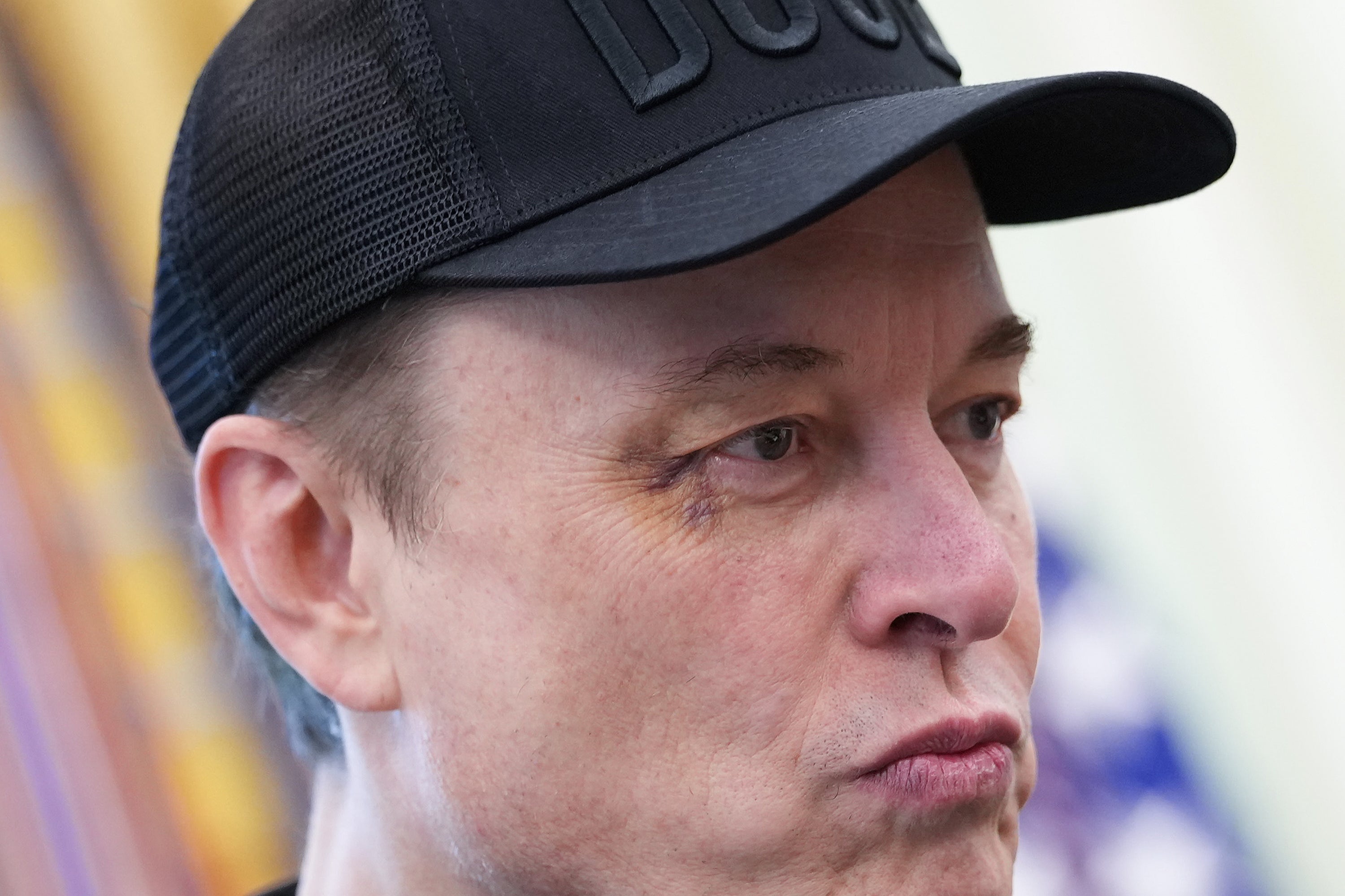 The billionaire turned up to the White House with the shiner on his right eye. ‘I said go ahead and punch me in the face and he did,’ Musk said.
