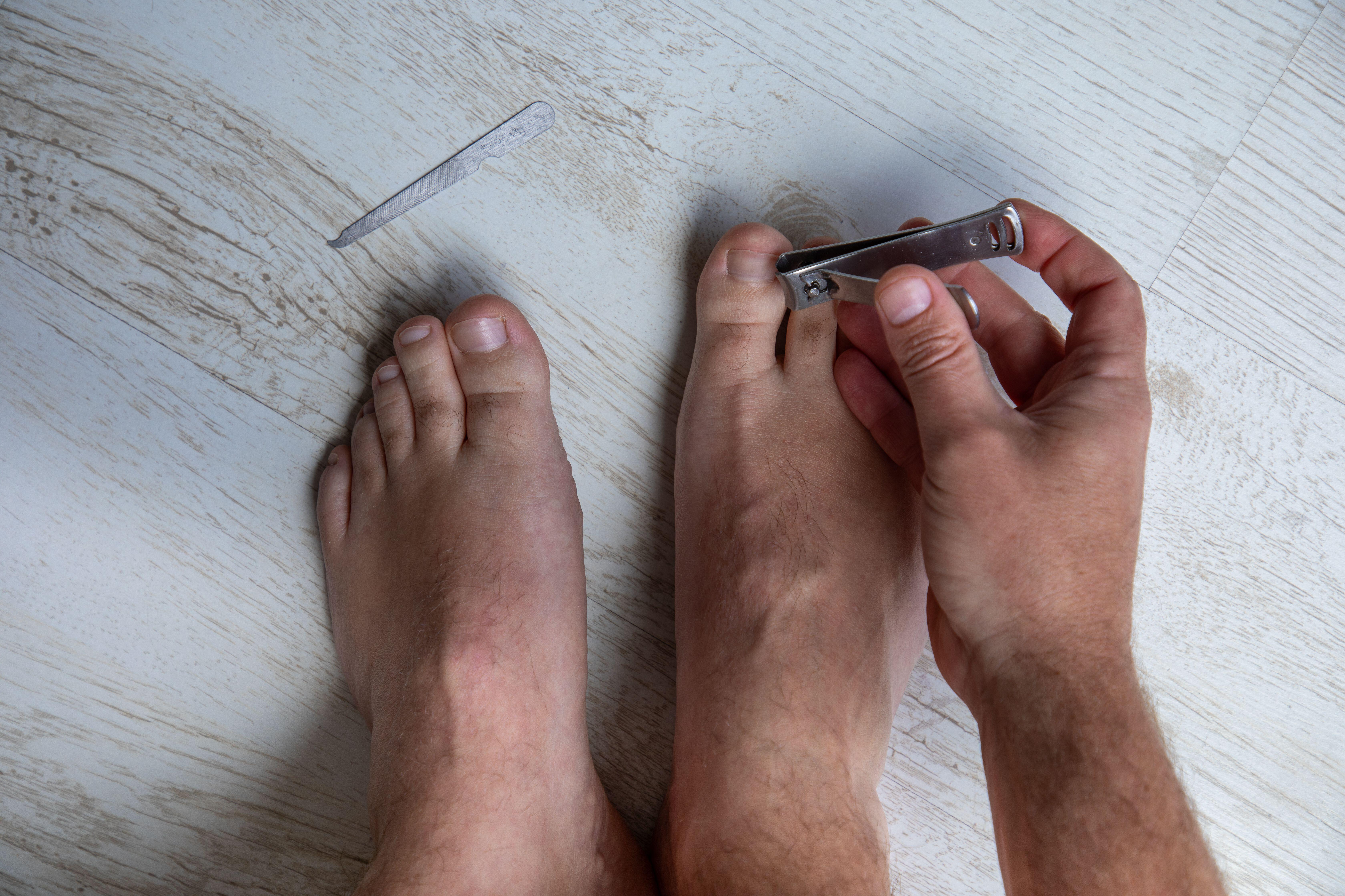 Toenails should be cut and trimmed regularly