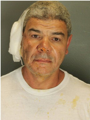 An arrest mugshot appeared to show Soliman with burns to his face and his right ear bandaged. He sustained injuries to his hands and was taken to a local hospital for treatment after his arrest, according to police
