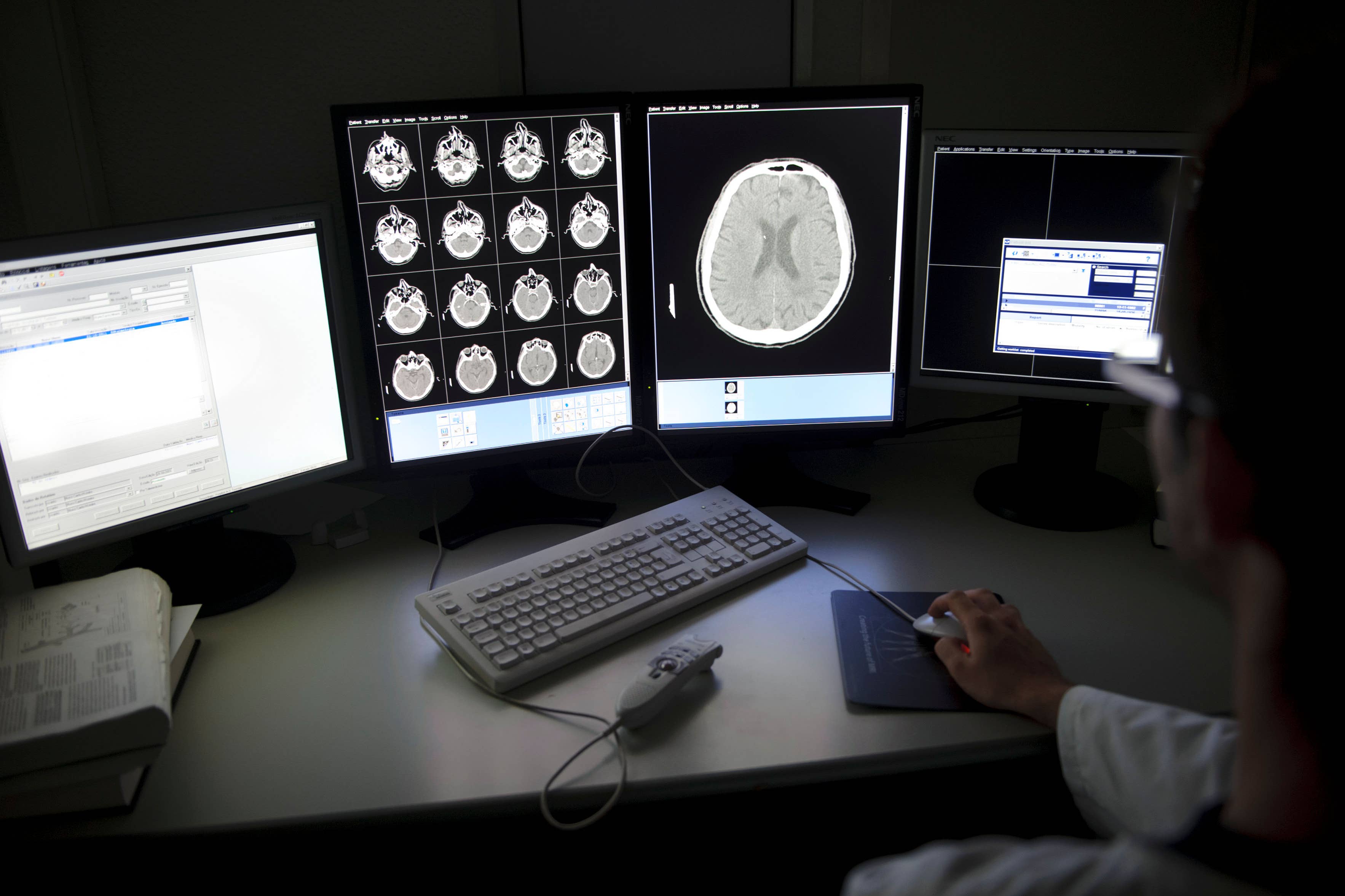 Experts have said that there is ‘hope on the horizon’ after a rise in the number of trials examining new Alzheimer’s drugs (Alamy/PA)