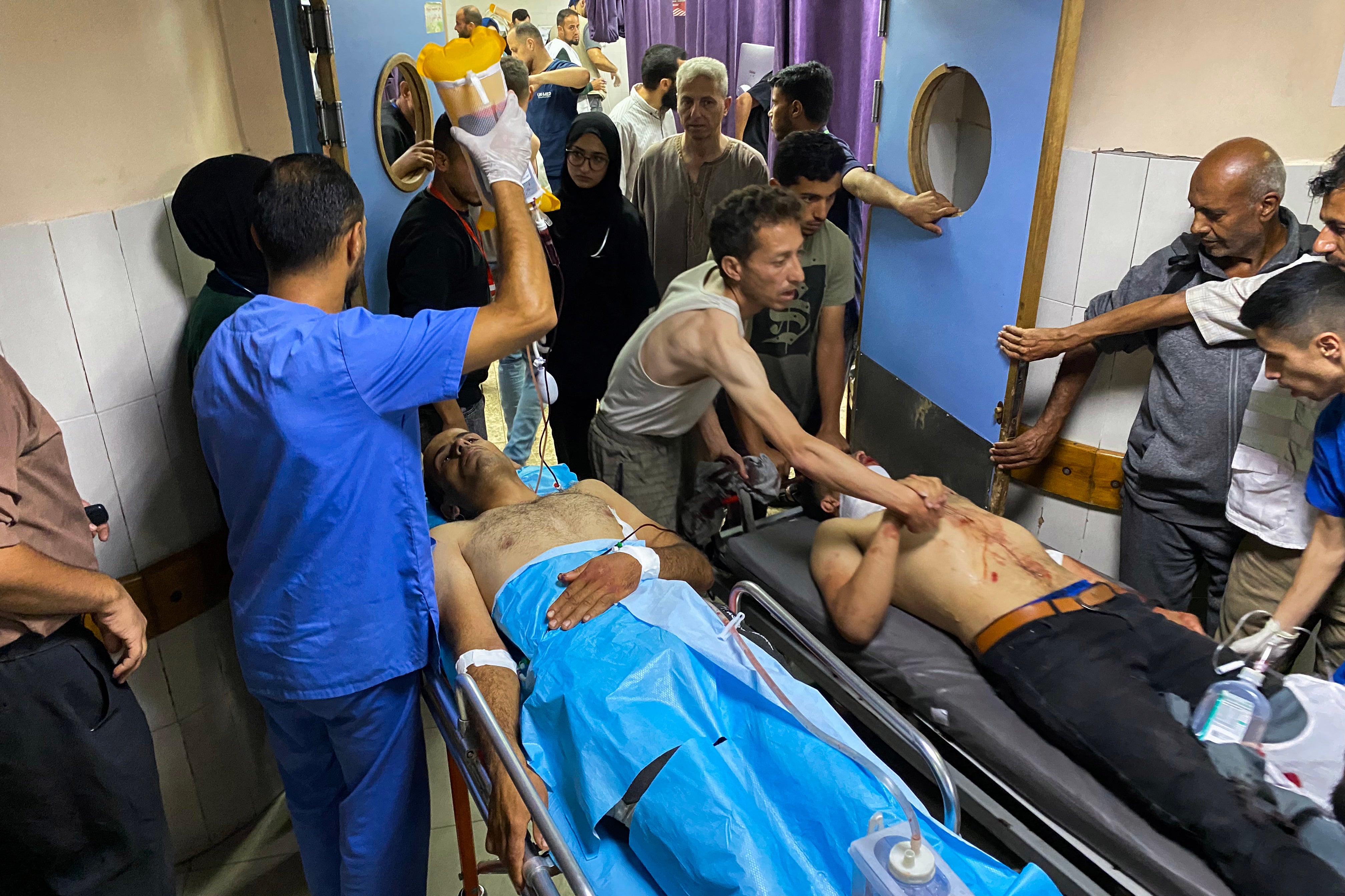 Palestinians injured by Israeli fire near a Rafah aid distribution centre on 3 June receive treatment at the Nasser hospital in Gaza