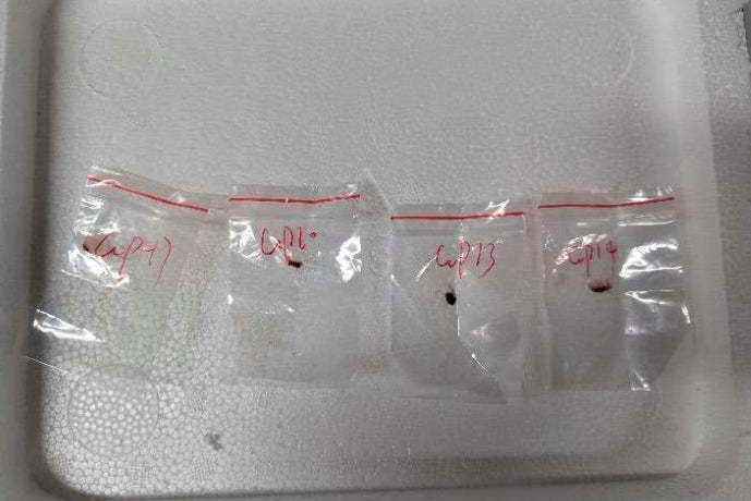 US Dangerous Fungus