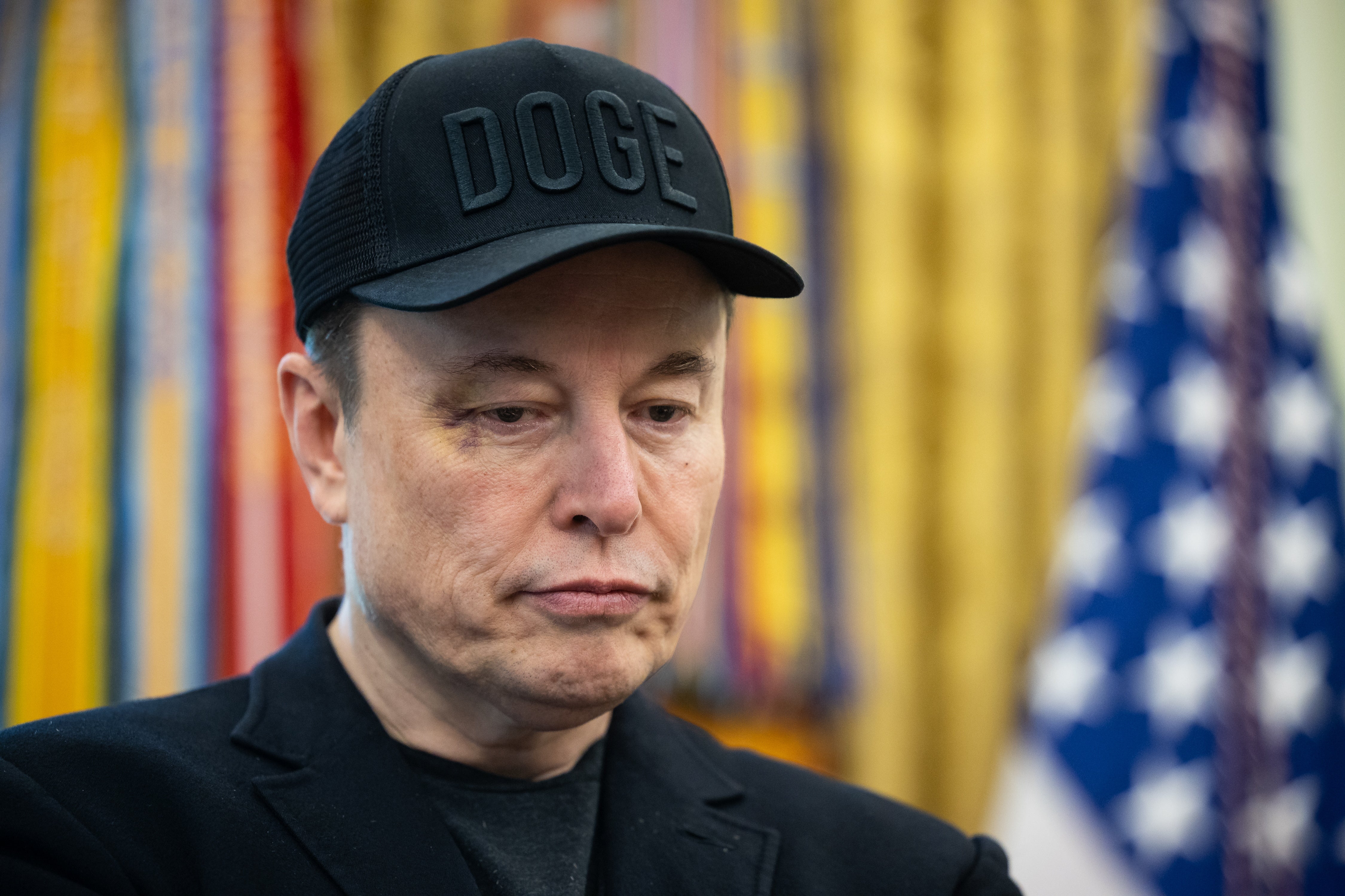 Musk was pictured in recent days sporting a black eye