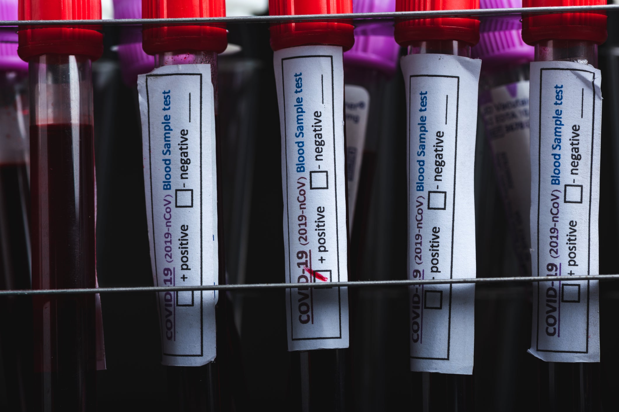 SARS-cov-2 caused the pandemic that started in 2019