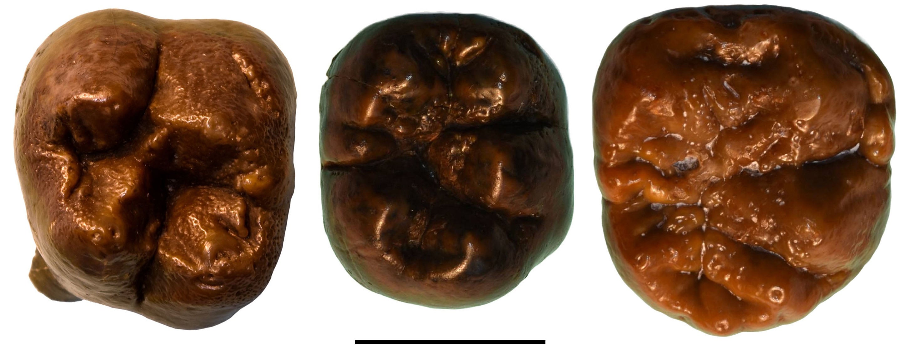 Paranthropus enamel pitting