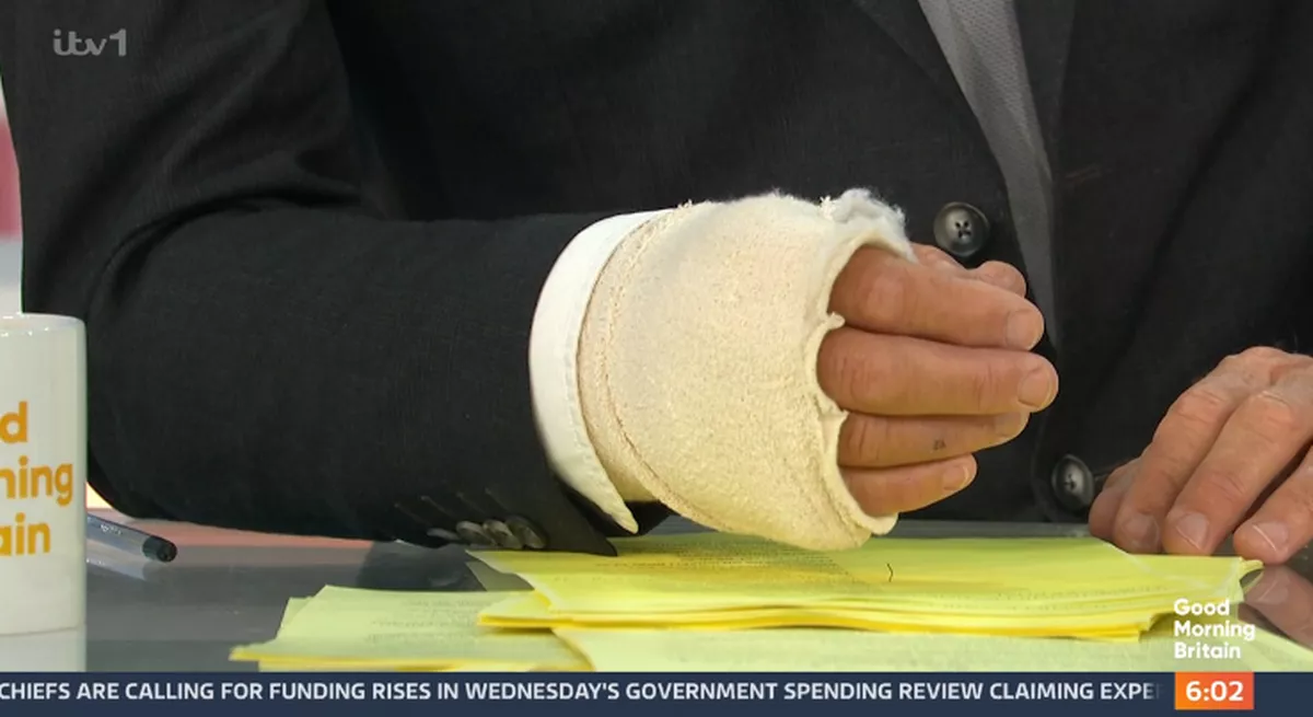 Richard Madeley shows his brittle wrist on good morning Britain