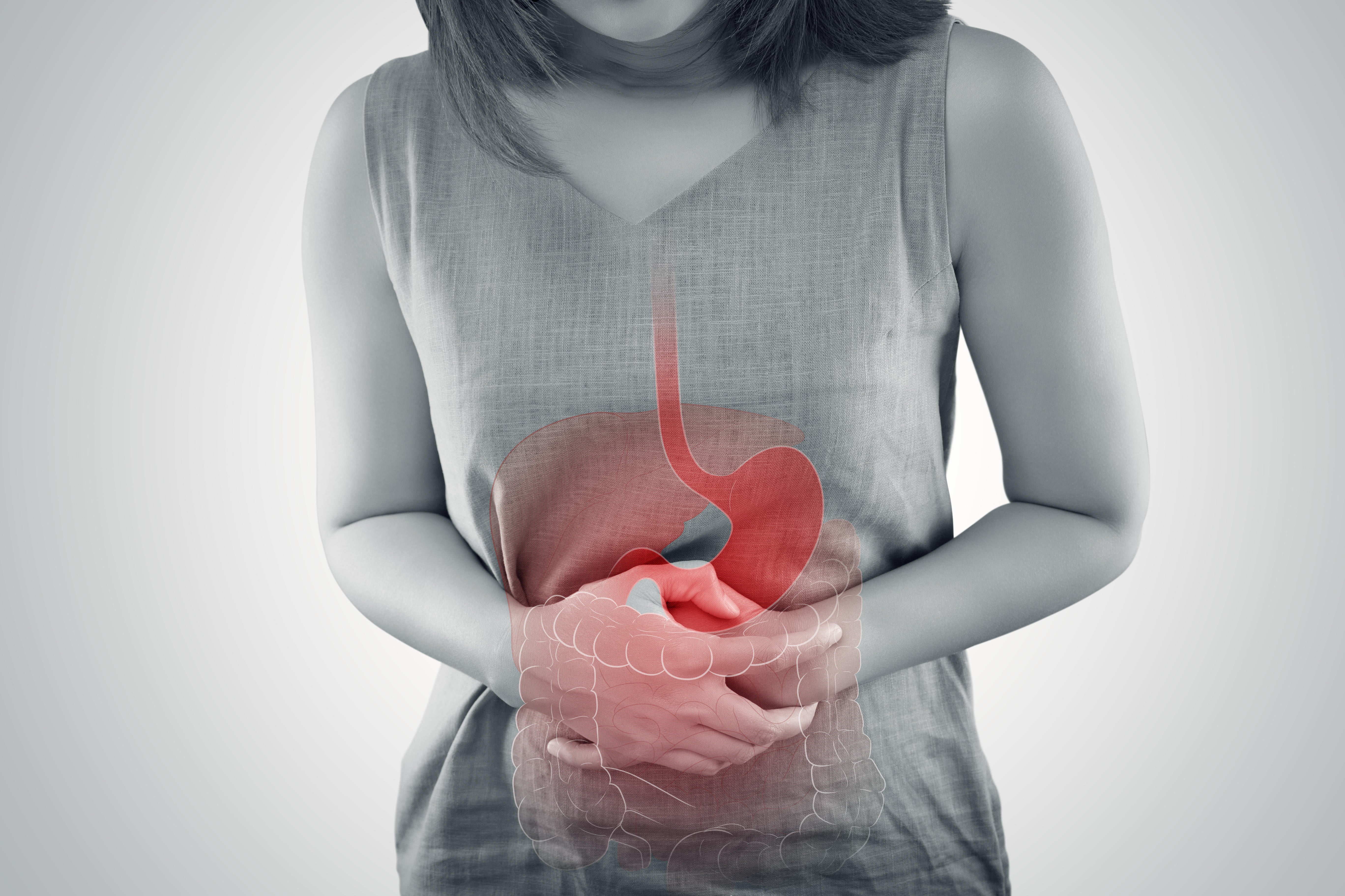 A colite ulcerosa é um tipo de doença inflamatória que afeta o intestino grosso