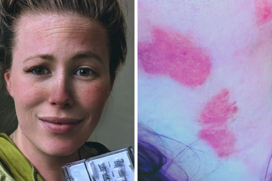 Isabell Anderson, a mother of three from York County, PA, was engulfed in flames in a smoker incident on Memorial Day.