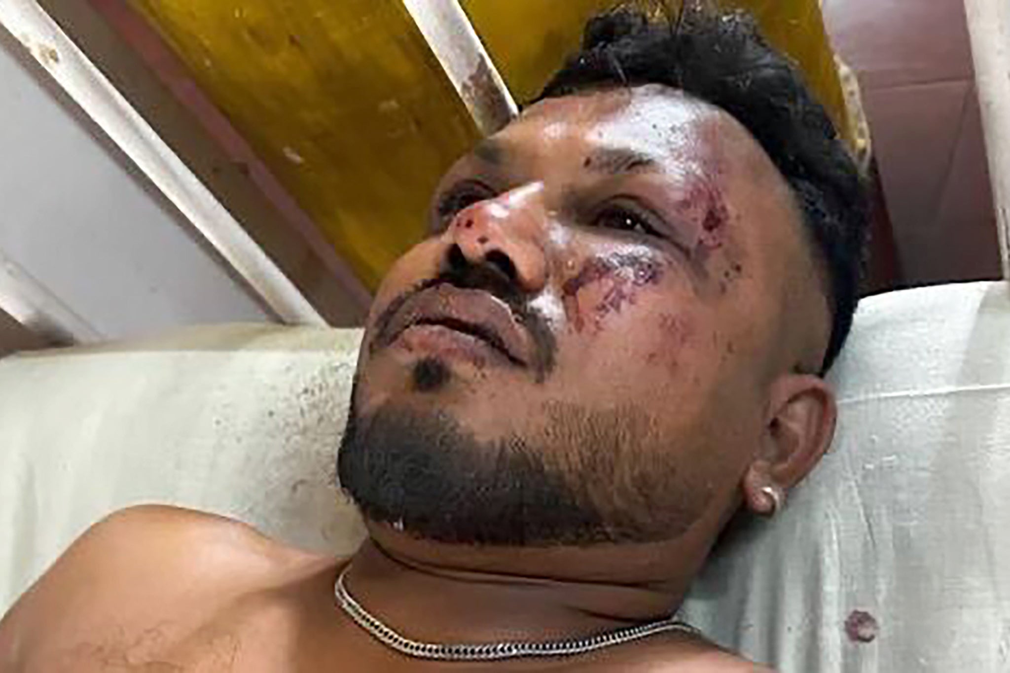 Viswashkumar Ramesh is said to be the sole survivor of the crash