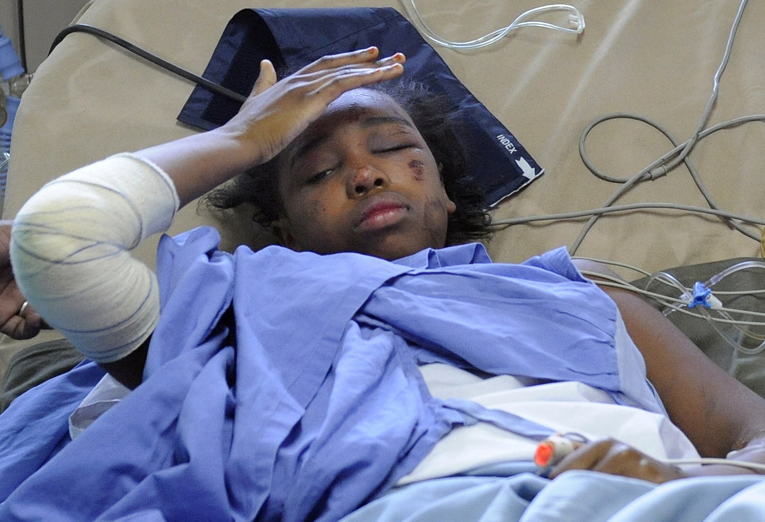 Bahia Bakari in a hospital bed after surviving the plane crash in Comoros