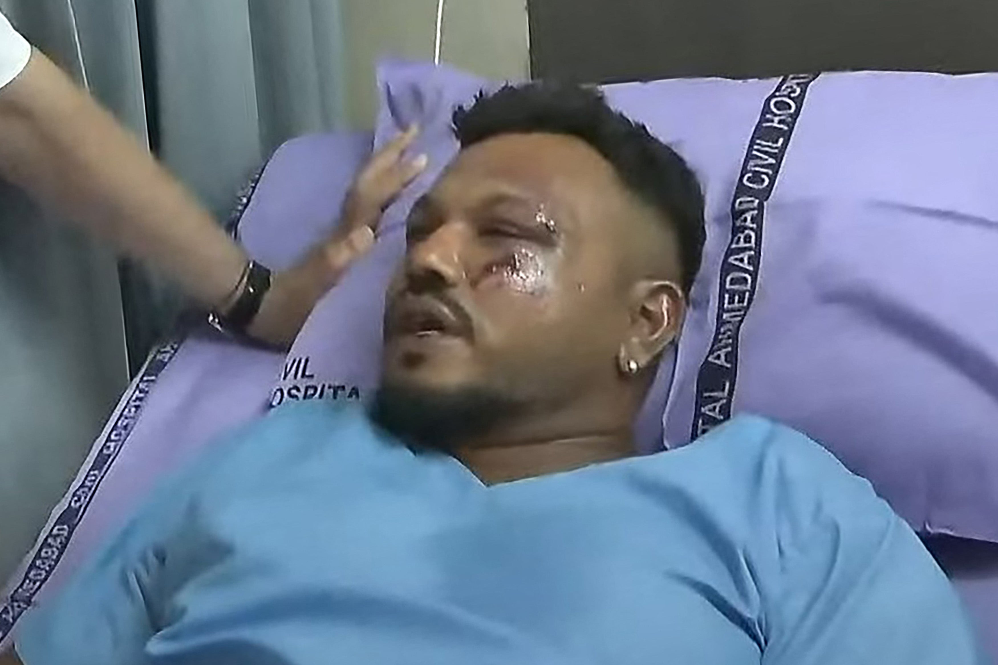 Viswashkumar Ramesh in hospital after escaping the Air India crash alive