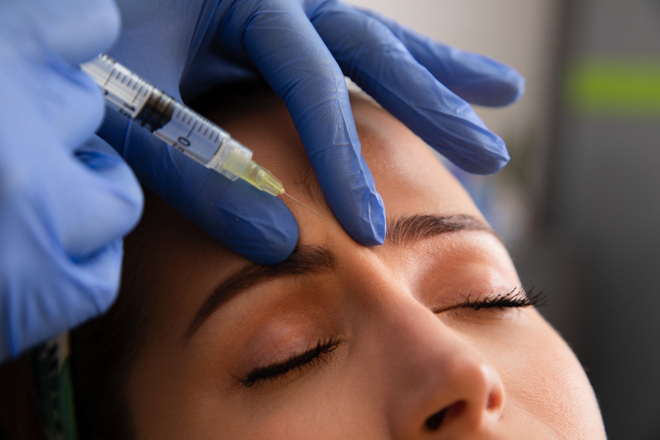 Botulinum toxin je nejběžnějším nechirurgickým postupem prováděným globálně