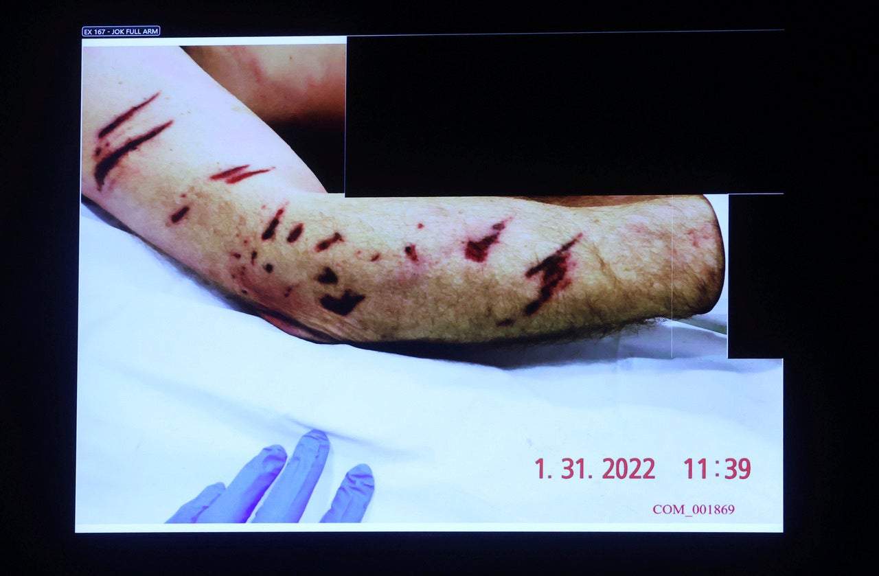During the trial, an autopsy photograph of the police officer John O'Keefe officer is shown