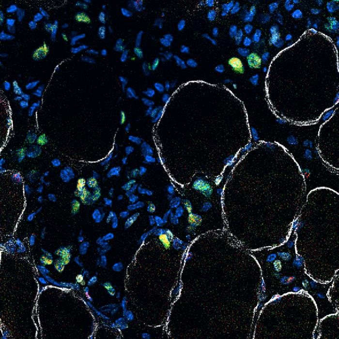 Stem cells at different stages of making muscle are stained in red, green and yellow