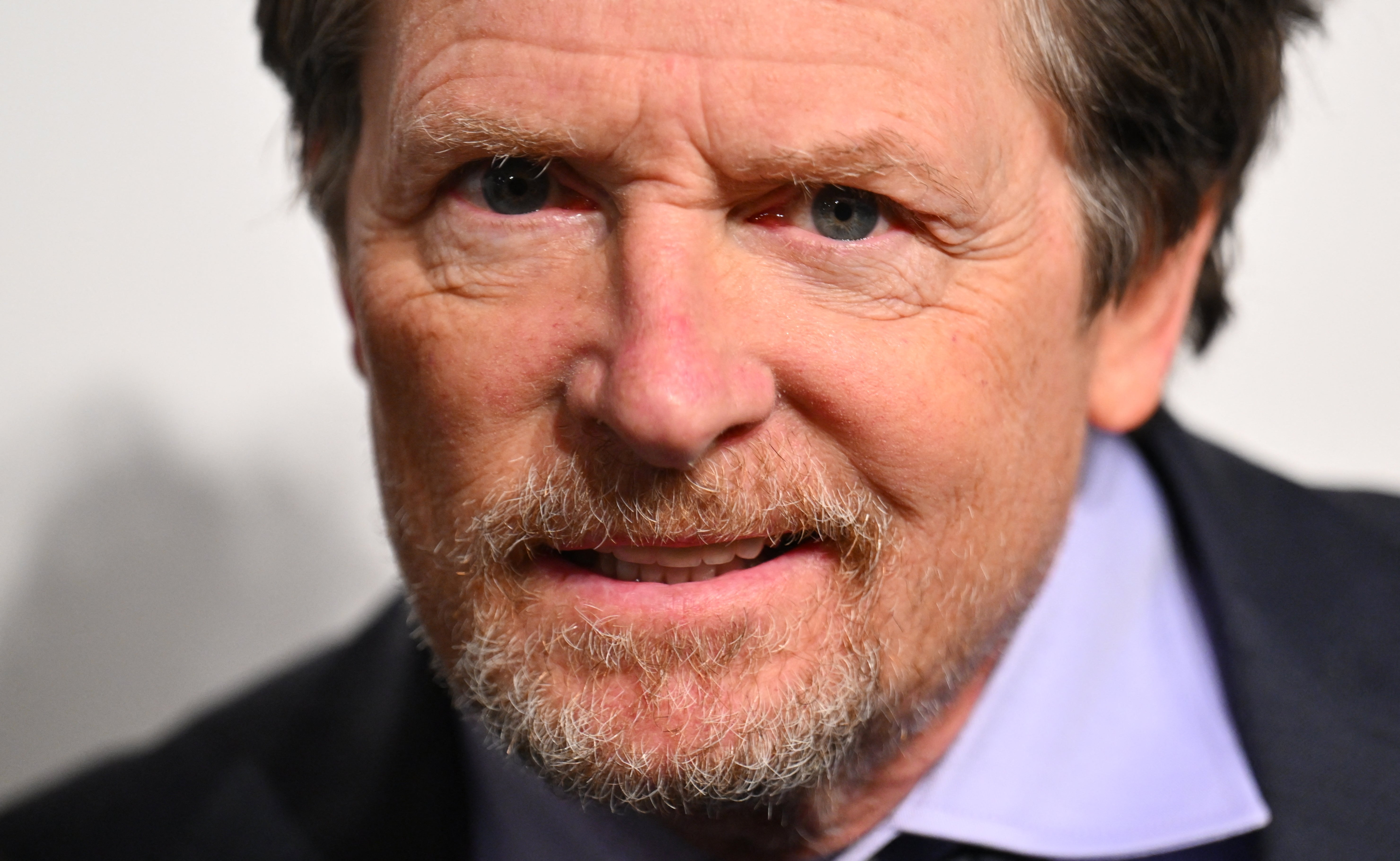 Many celebrities have been diagnosed with Parkinson's disease, including actor Michael J. Fox and singer Neil Diamond. Some 90,000 people are diagnosed with the condition each year in the U.S.